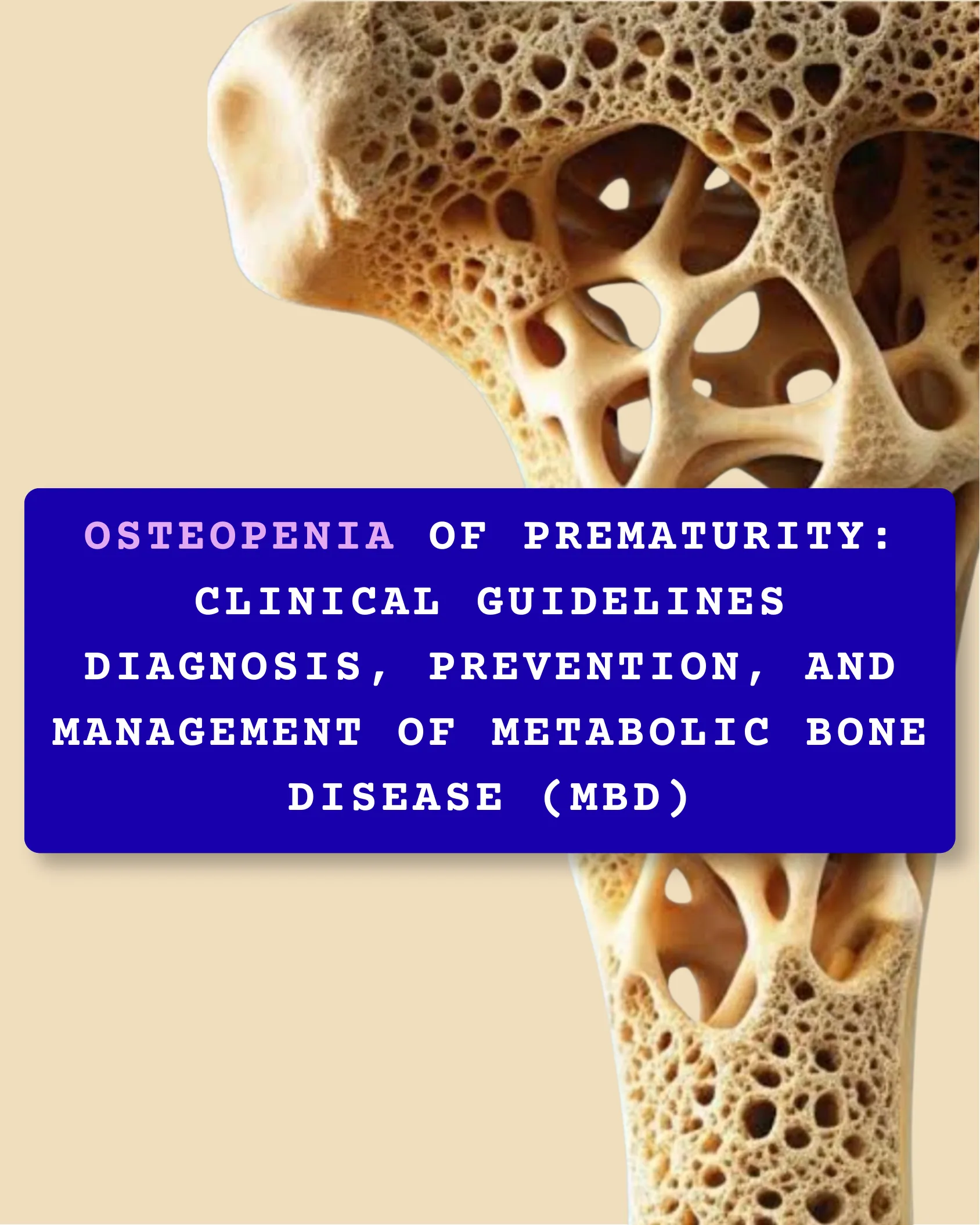 Osteopenia of Prematurity: क्लिनिकल गाइडलाइन्स निदान, रोकथाम, और मेटाबॉलिक बोन डिजीज (MBD) के प्रबंधन के लिए