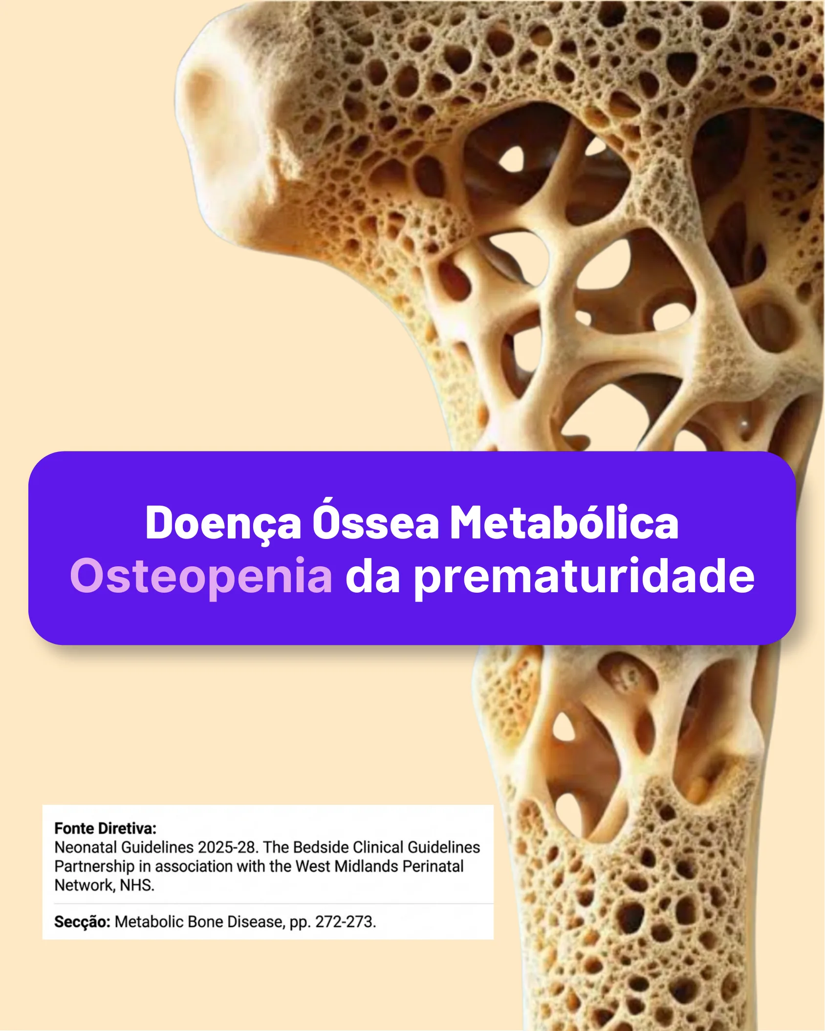 Capa do documento clínico sobre osteopenia da prematuridade com imagem ampliada de tecido ósseo trabecular.