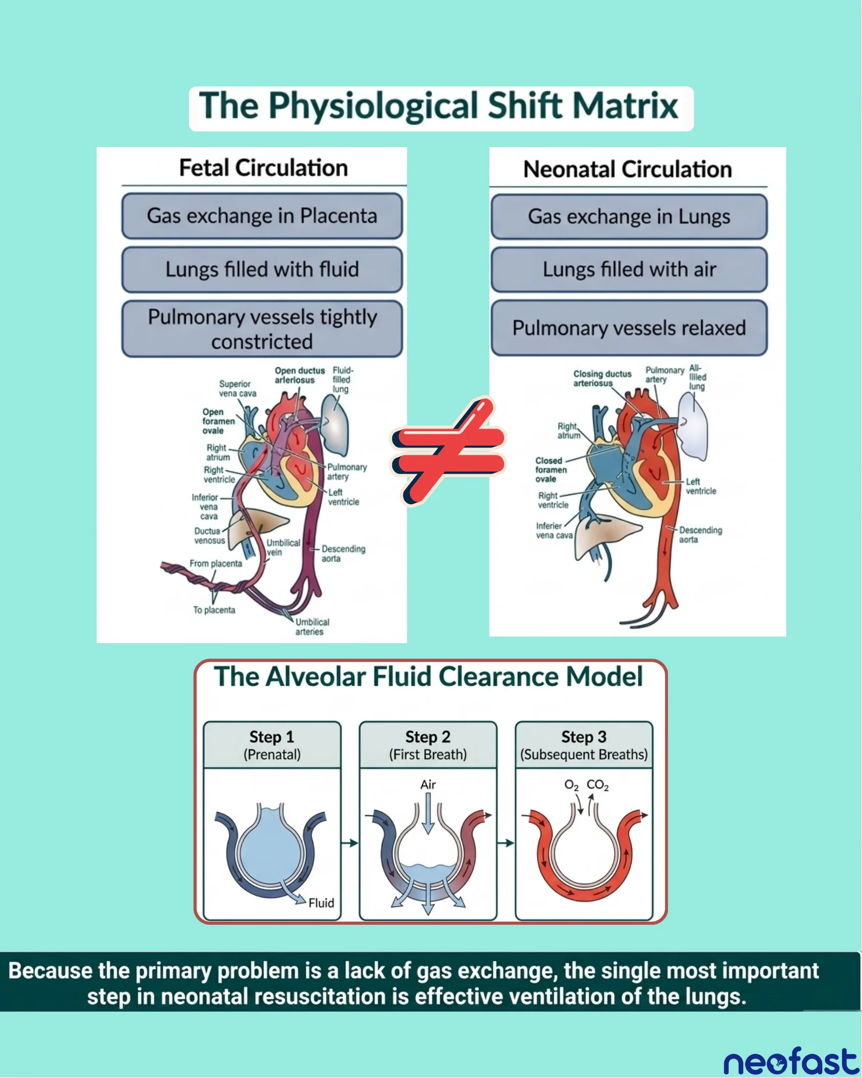 Diagram comparing fetal circulation and neonatal circulation anatomy side by side, with a not-equal sign between them, plus a three-step Alveolar Fluid Clearance Model showing fluid-filled lungs transitioning to air-filled lungs.