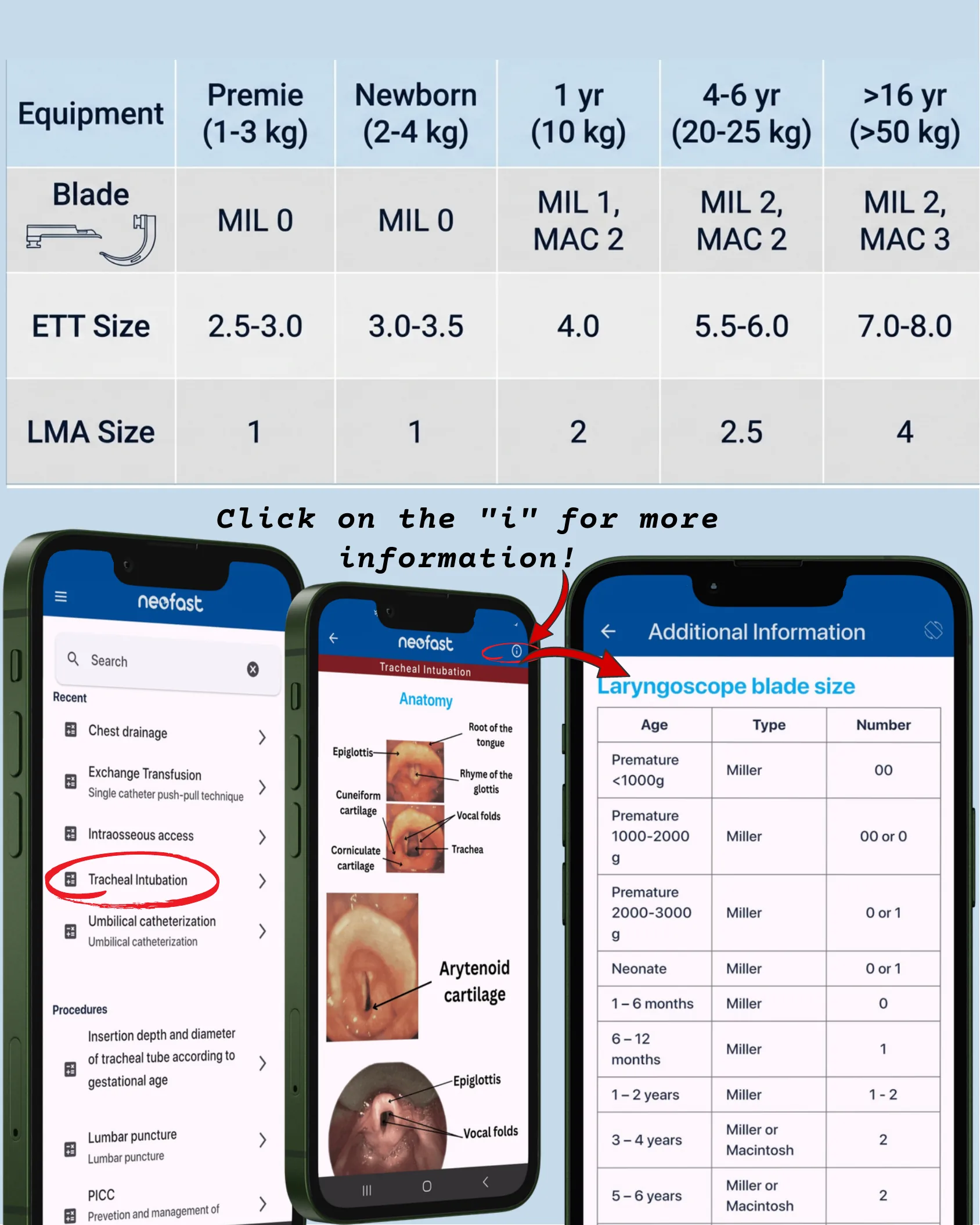 Equipment sizing table for laryngoscope blade, ETT and LMA by age and weight, with smartphone screenshots of the neofast app.