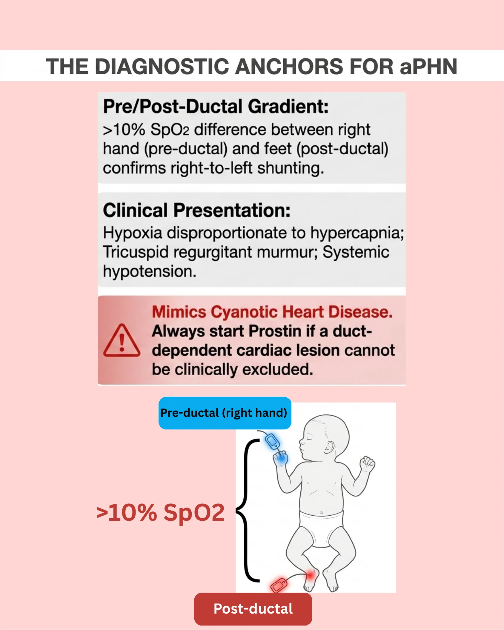 Infographic detailing diagnostic criteria for acute pulmonary hypertension of the newborn including pre/post-ductal SpO2 gradient, clinical presentation, and a warning about mimicking cyanotic heart disease, with a diagram of an infant showing pre-ductal and post-ductal pulse oximetry placement.
