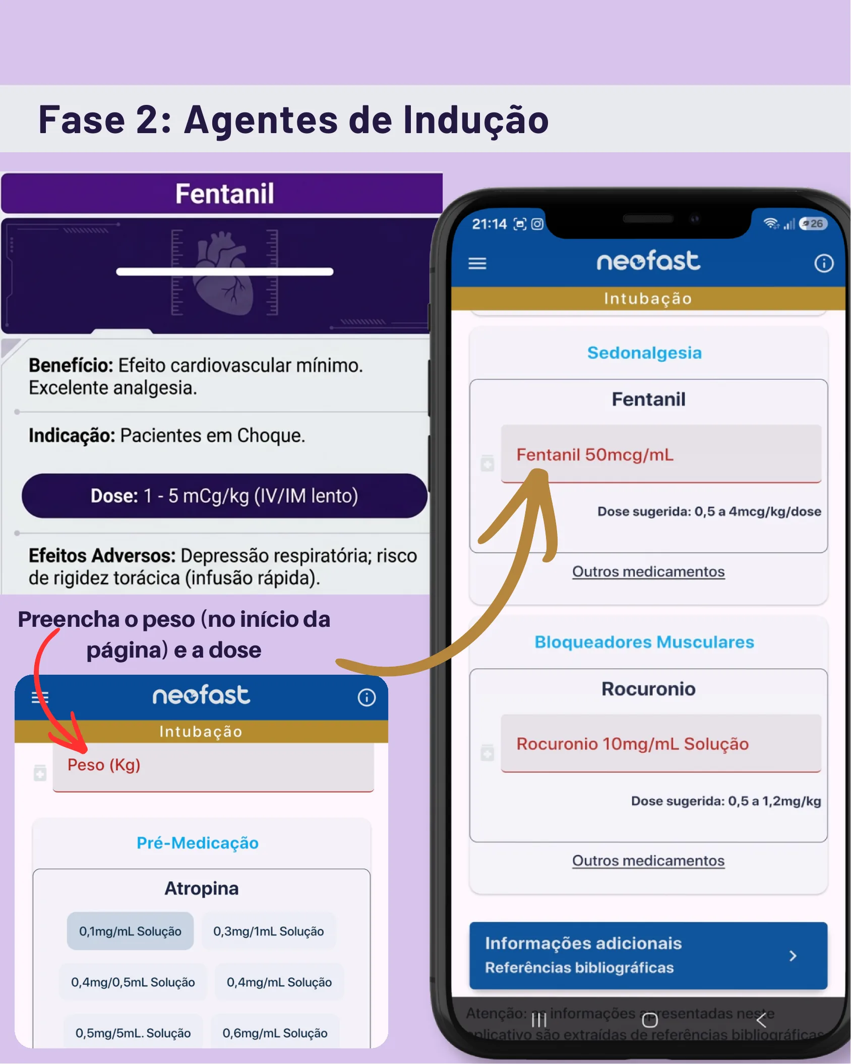 Comparação entre o cartão informativo do Fentanil e a tela do aplicativo Neofast mostrando o cálculo de doses de Fentanil e Rocurônio na seção de Intubação.