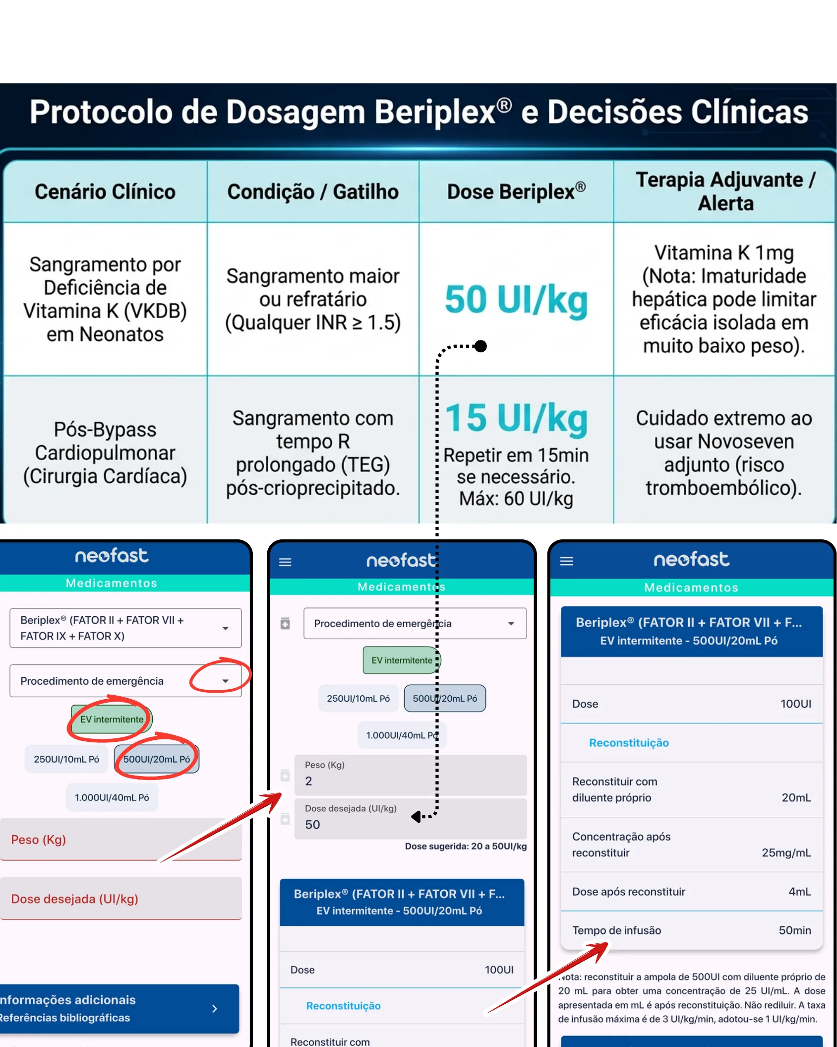 Tabela de protocolo de dosagem do Beriplex por cenário clínico e sequência de telas do aplicativo NeoFast demonstrando o cálculo de dose para um paciente neonato.