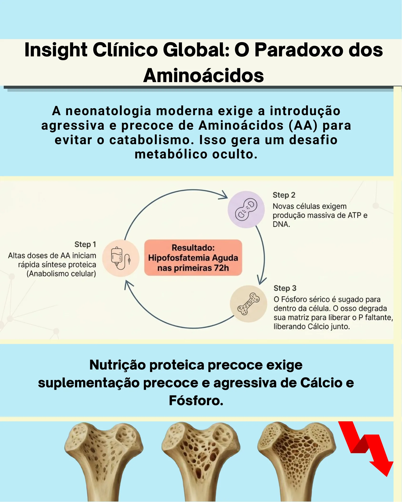 Fluxograma circular explicando como a introdução precoce de aminoácidos causa hipofosfatemia aguda, acompanhado de imagens de ossos com desmineralização progressiva.