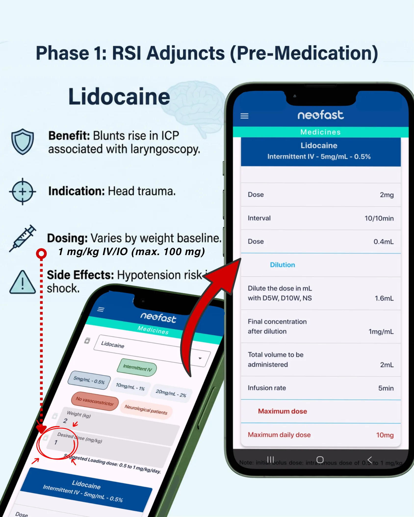 Lidocaine pre-medication summary with app screenshots showing dose, dilution, and maximum daily dose.