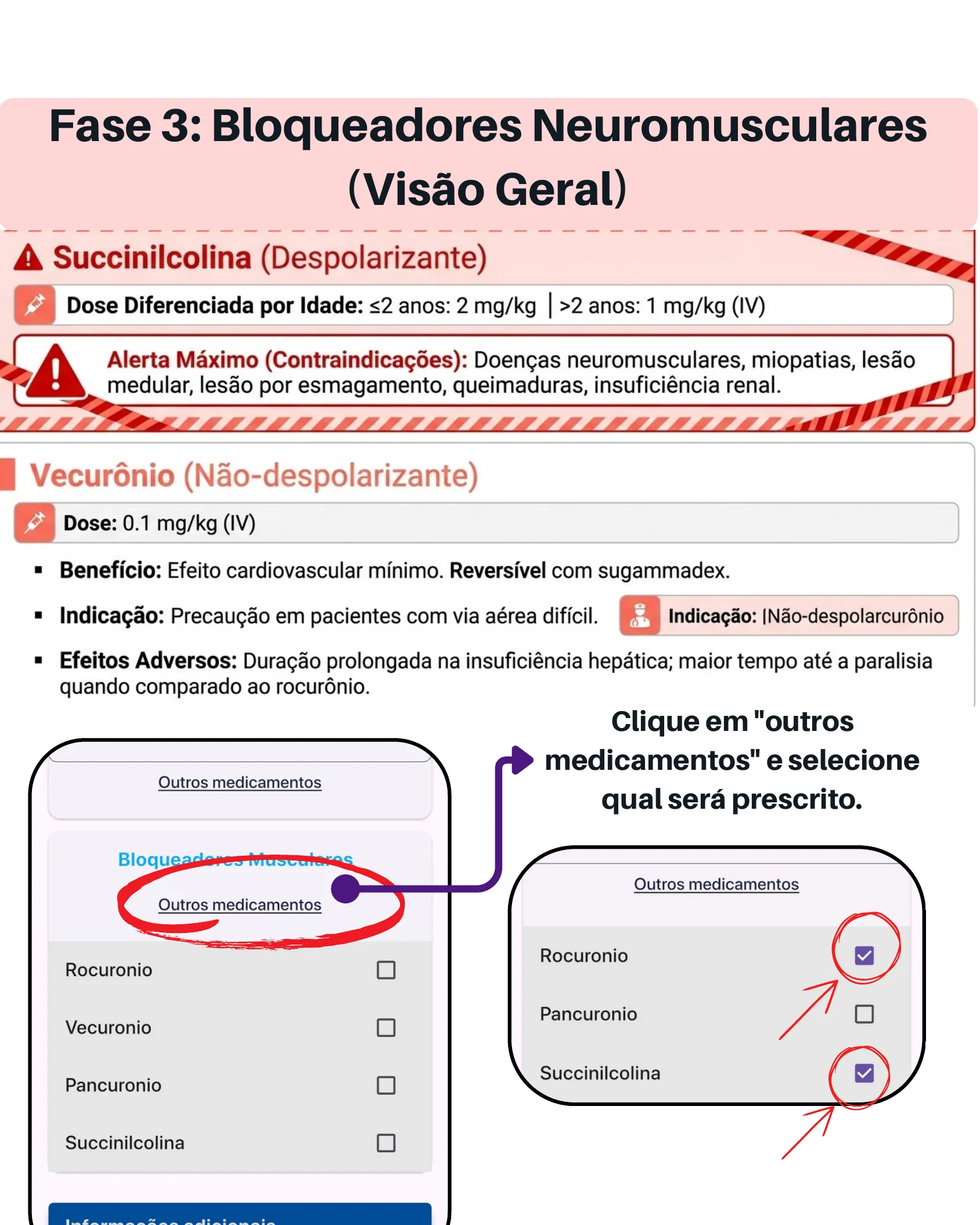 Cartão comparativo entre Succinilcolina e Vecurônio com alertas de contraindicação, e telas do aplicativo Neofast mostrando como selecionar outros bloqueadores musculares.
