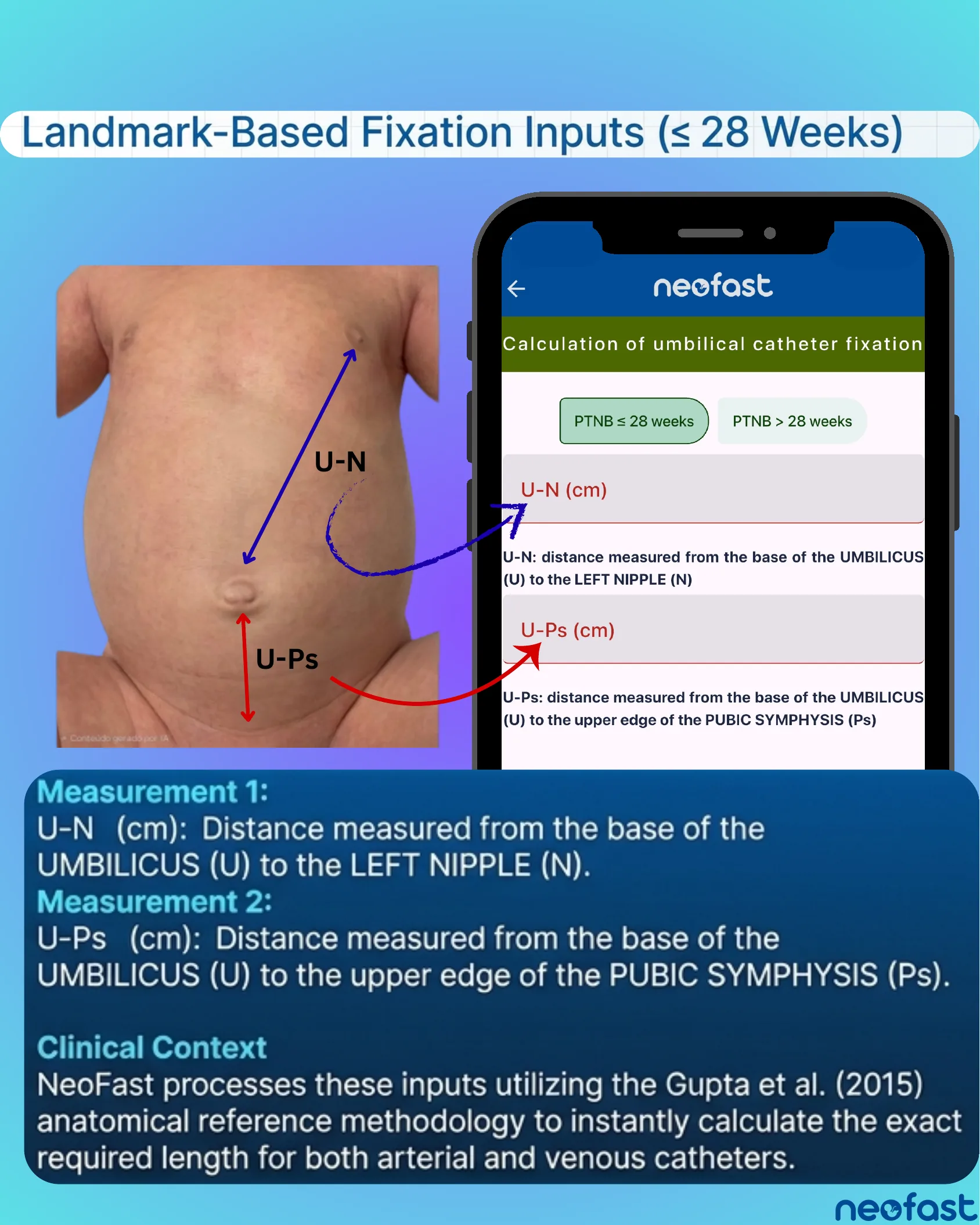 Photo of a neonatal abdomen with U-N and U-Ps measurement arrows next to a NeoFast app screen for entering umbilical catheter fixation inputs.