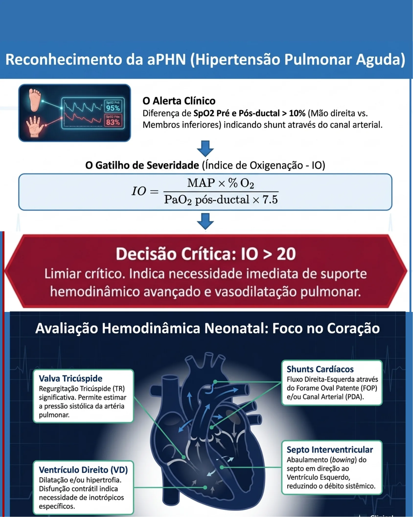 Infográfico sobre reconhecimento da hipertensão pulmonar aguda neonatal com sinais clínicos, fórmula do índice de oxigenação e avaliação hemodinâmica ecocardiográfica.