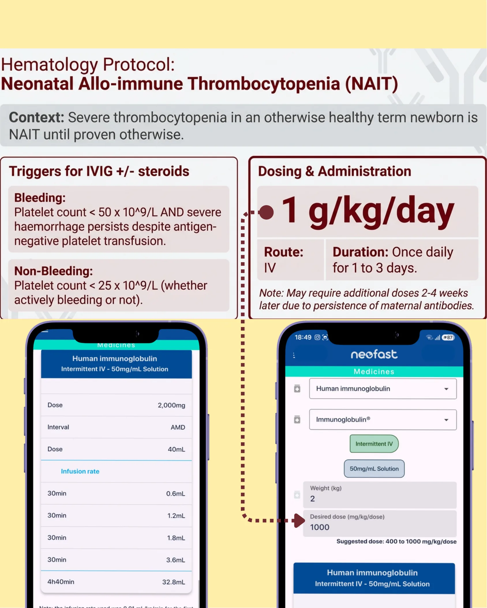 Protocol diagram for NAIT showing context, bleeding and non-bleeding triggers for IVIG, dosing at 1 g/kg/day, and two Neofast app screenshots showing dosing and infusion rate calculations.
