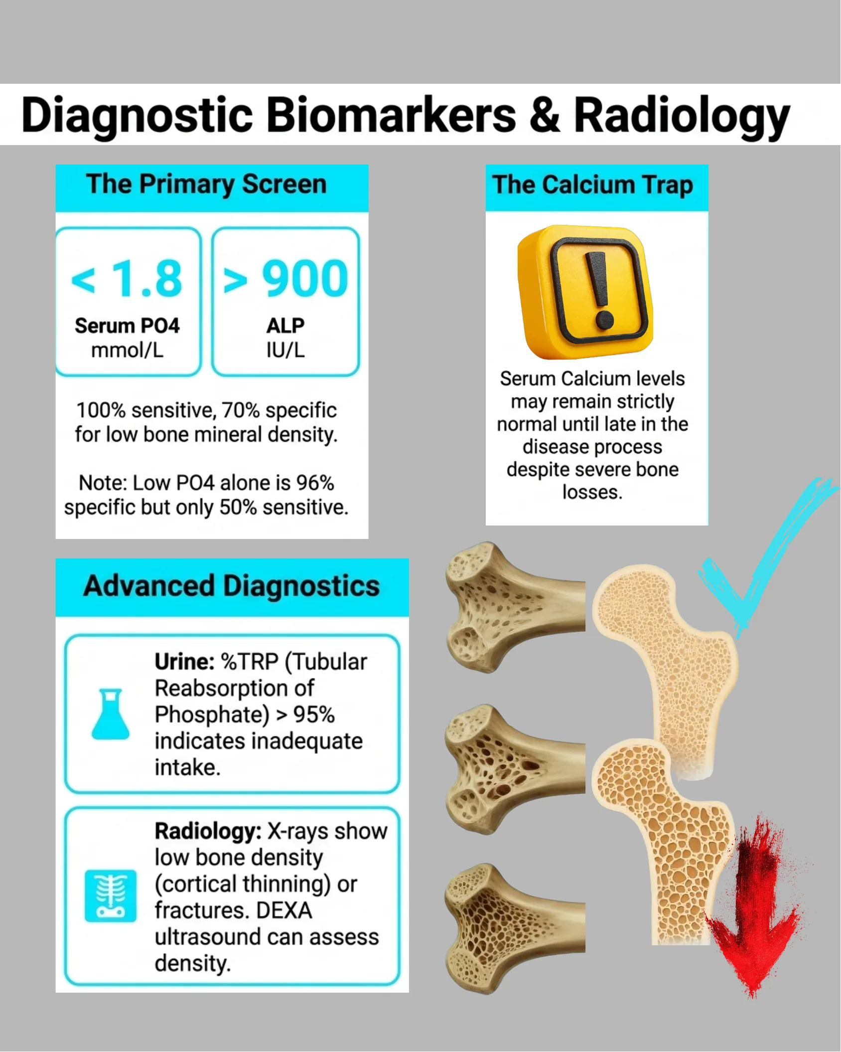 Infographic detailing diagnostic biomarker thresholds for serum phosphate and ALP, a warning about normal calcium levels masking bone loss, and advanced diagnostics including urine TRP and radiology, with bone density illustrations.
