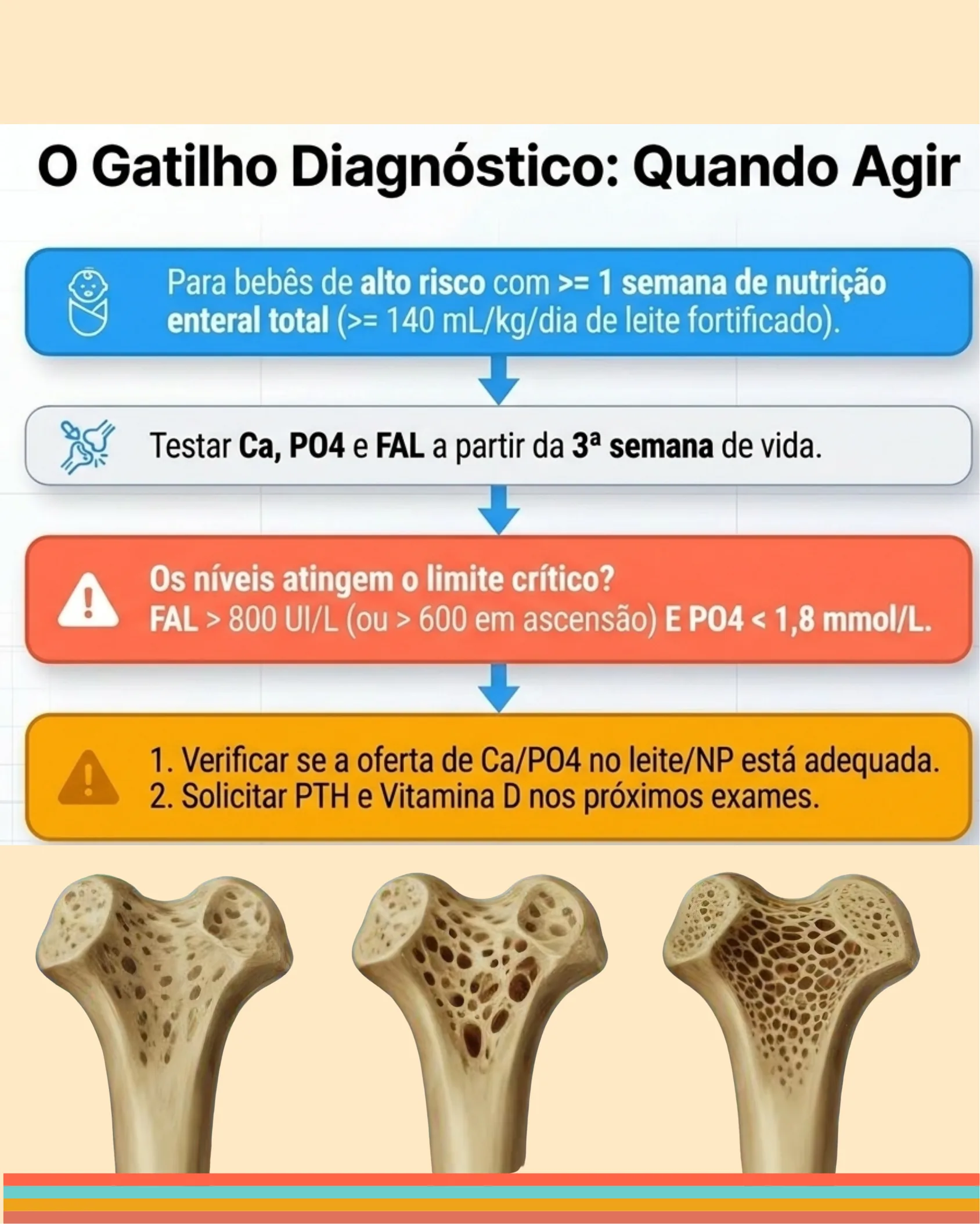 Fluxograma mostrando quando testar e agir diagnosticamente em bebês de alto risco, com imagens de ossos trabeculares mostrando progressão de osteoporose.