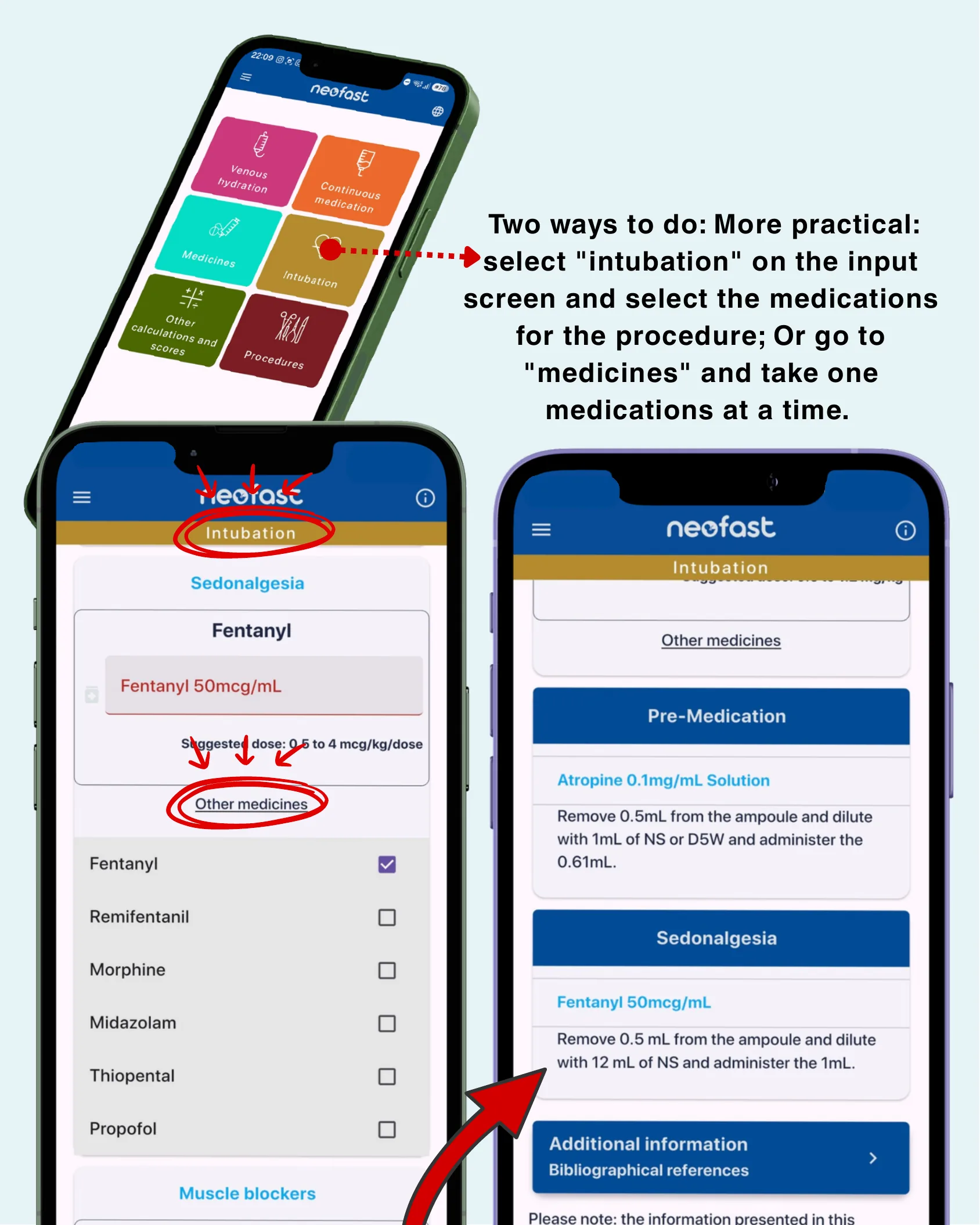 App workflow screenshots showing how to select intubation and choose medications, with pre-medication and sedonalgesia results.