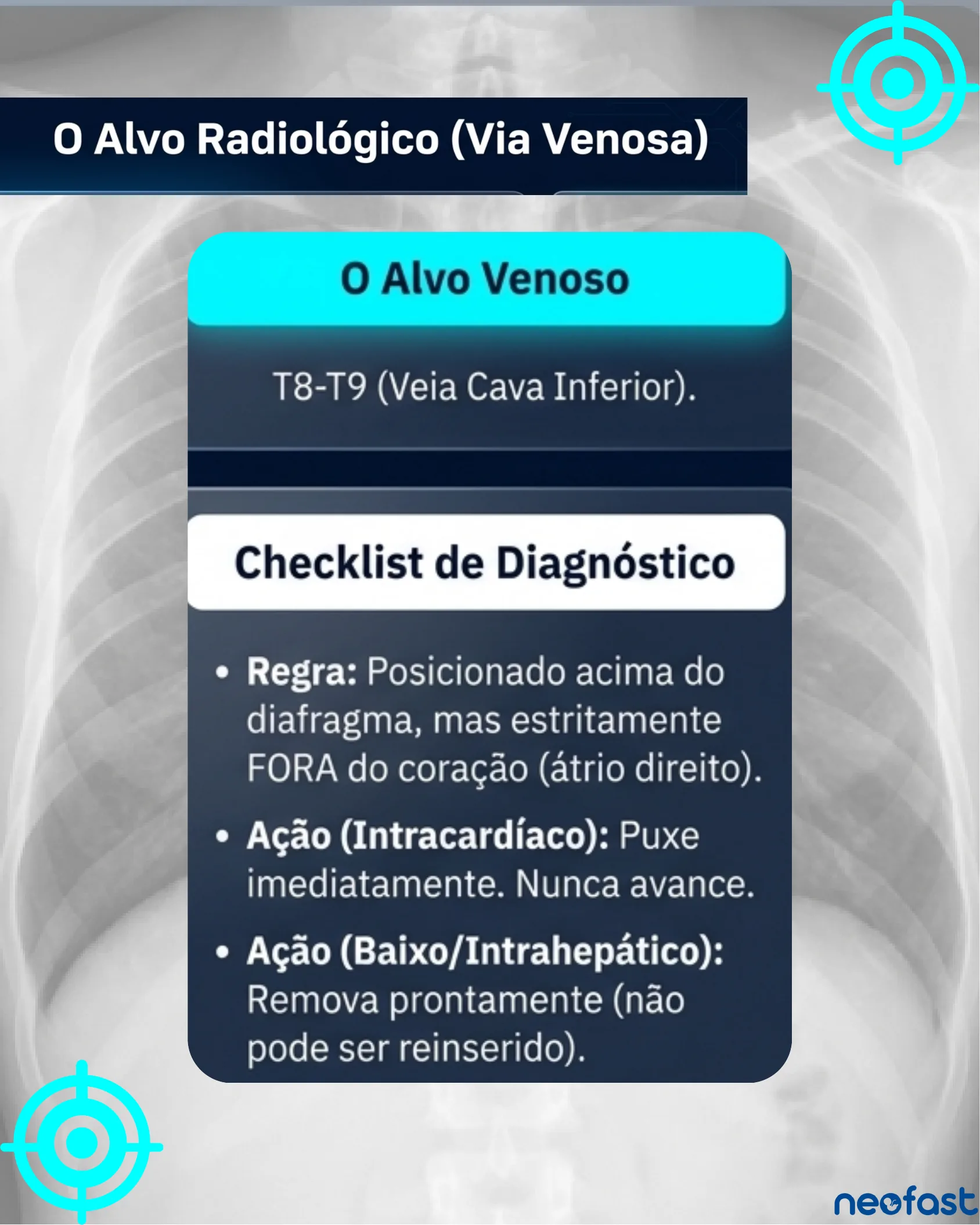 Radiografia de tórax neonatal com painel explicando o alvo venoso ideal em T8-T9 e checklist diagnóstico sobre posicionamento do cateter venoso umbilical.