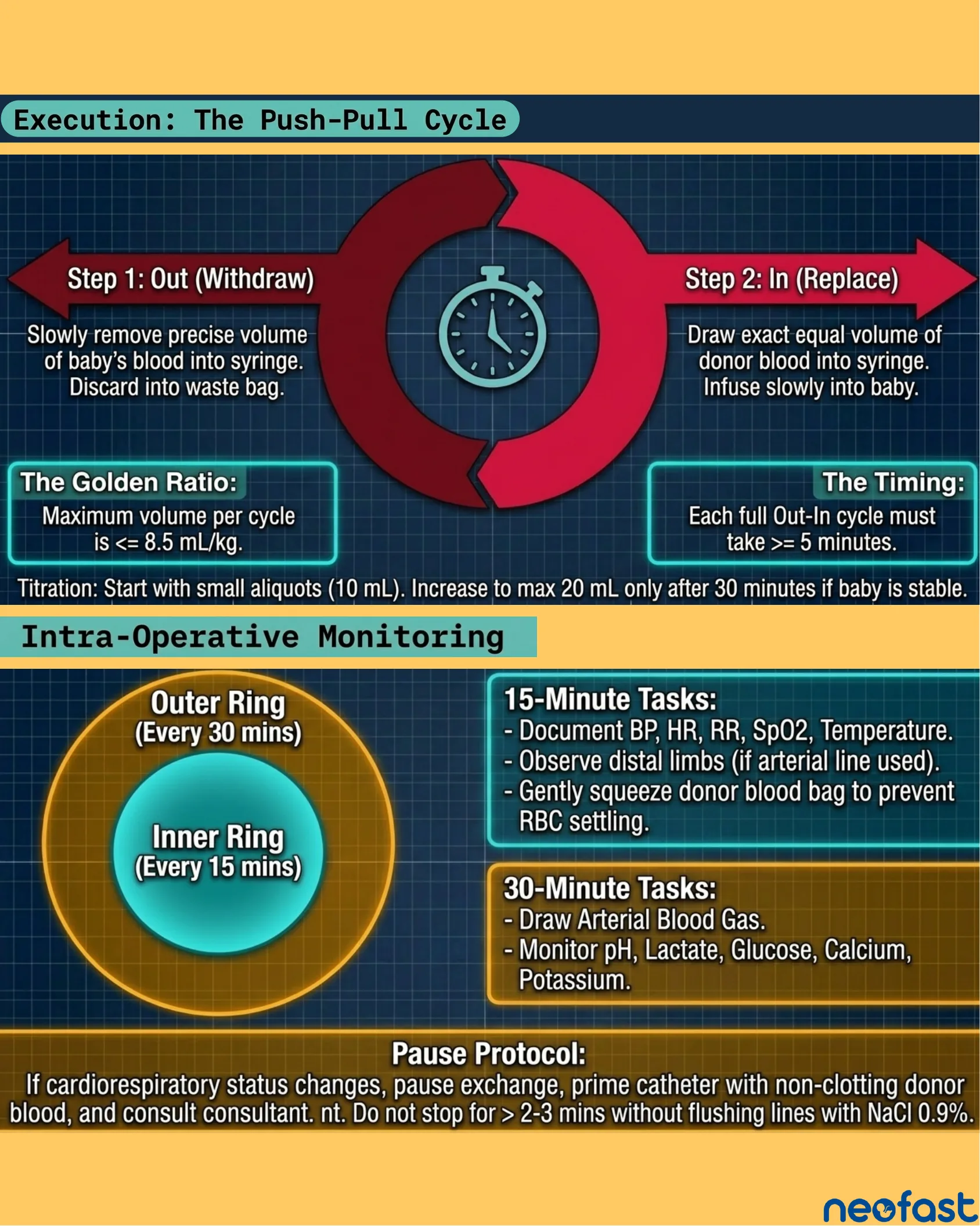 Diagram of the two-step push-pull exchange transfusion cycle (out/withdraw and in/replace) with golden ratio and timing rules, plus a monitoring schedule showing 15-minute and 30-minute tasks and a pause protocol.