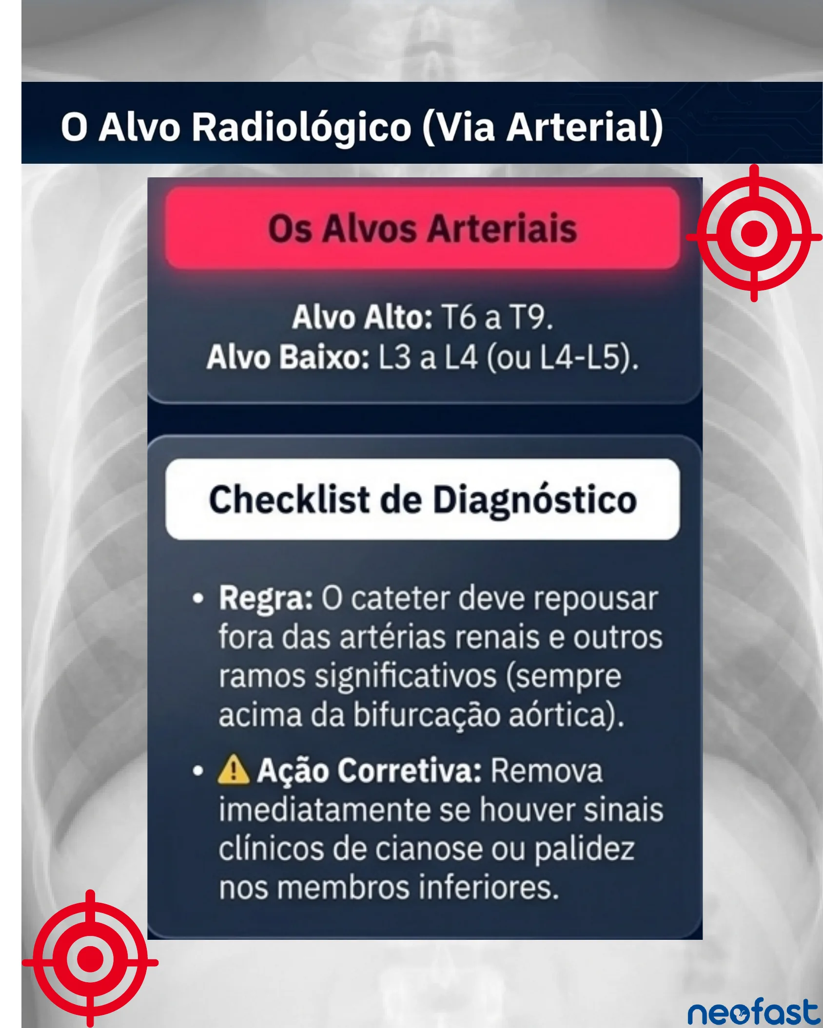 Infográfico listando os alvos radiológicos arteriais (alto e baixo) e um checklist de diagnóstico para o cateter arterial umbilical, sobre fundo de radiografia de tórax.