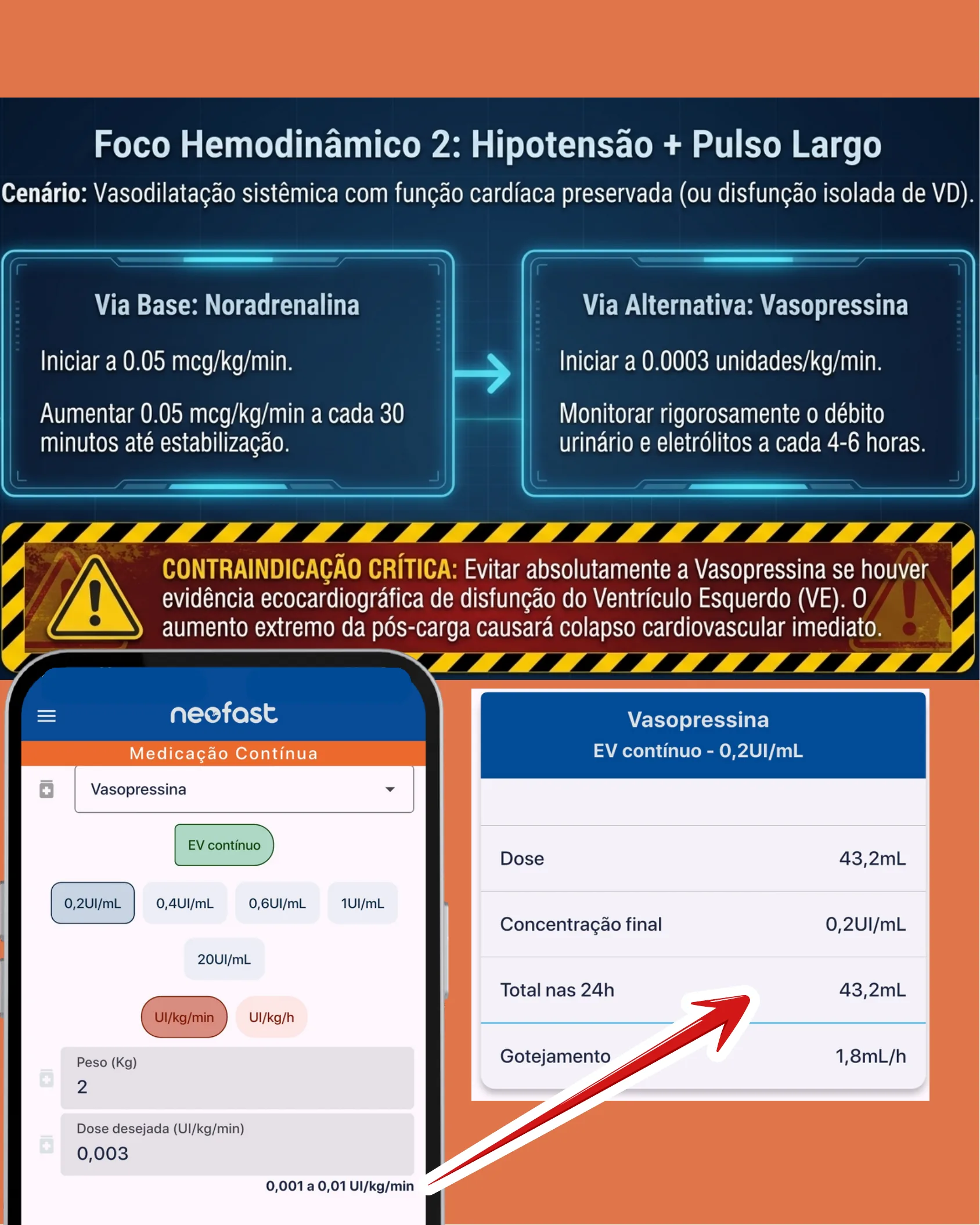 Infográfico sobre choque vasodilatatório com fluxograma de Noradrenalina e Vasopressina, aviso de contraindicação crítica e tela do app Neofast com cálculo de dose de Vasopressina.