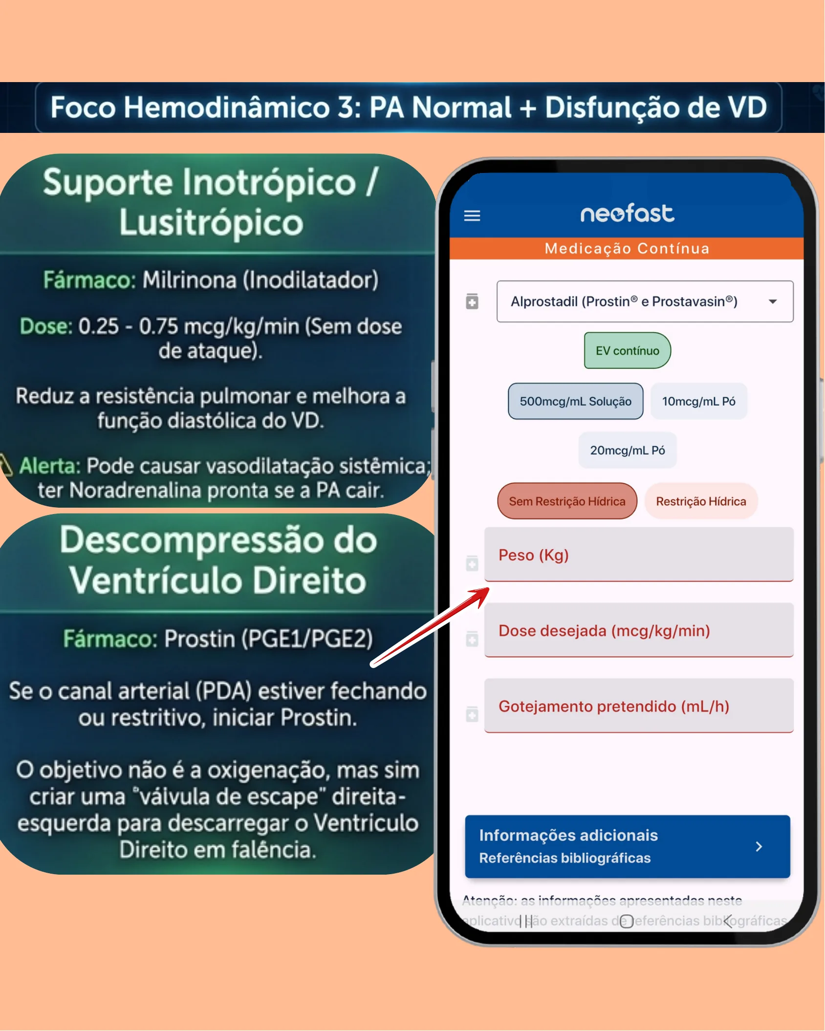 Cartões informativos sobre suporte inotrópico com Milrinona e descompressão do ventrículo direito com Prostin, ao lado da tela do app Neofast para cálculo de Alprostadil.
