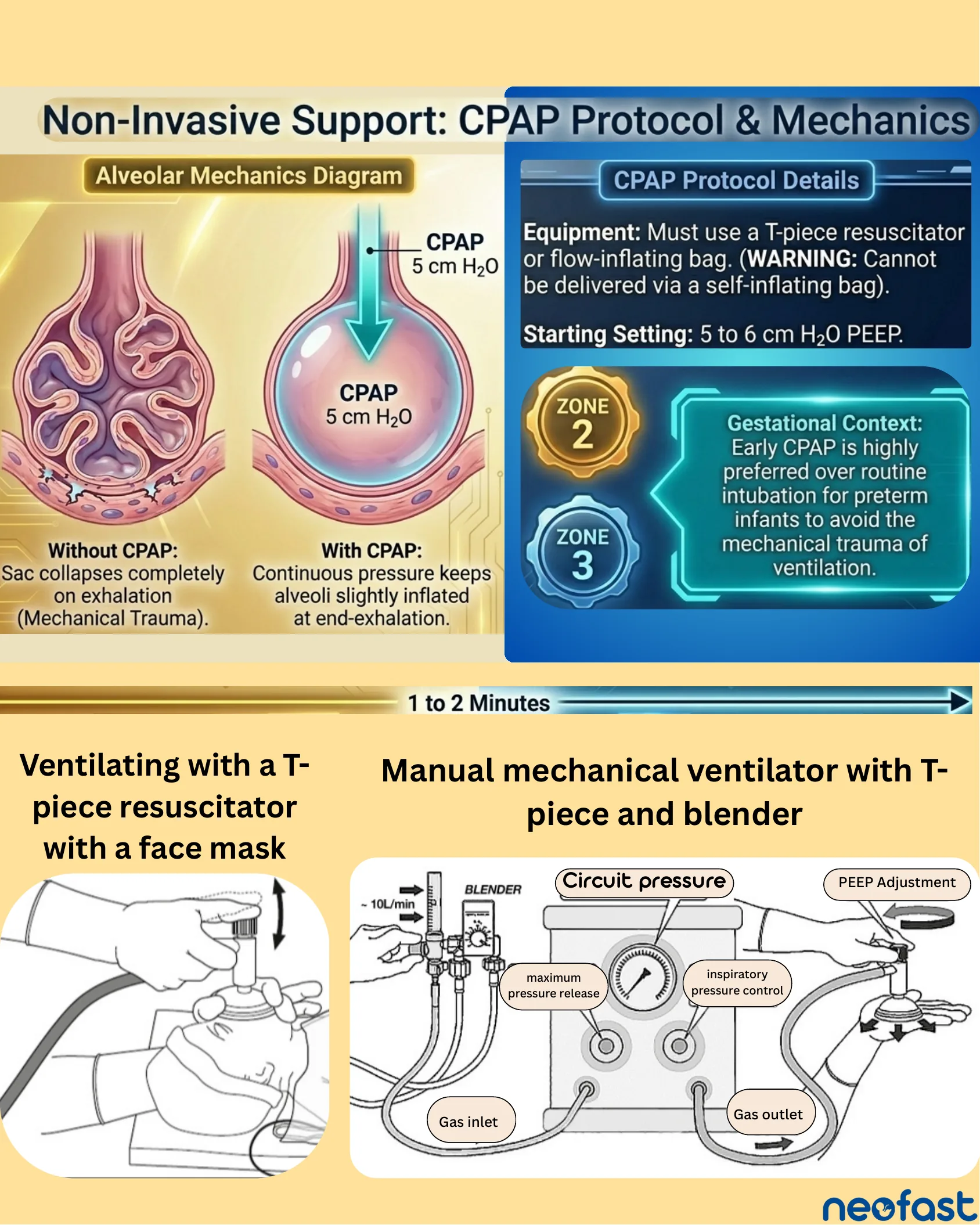 Diagram of alveolar mechanics with and without CPAP, CPAP protocol details, gestational context, and illustrations of ventilating with a T-piece resuscitator and a manual mechanical ventilator with blender.