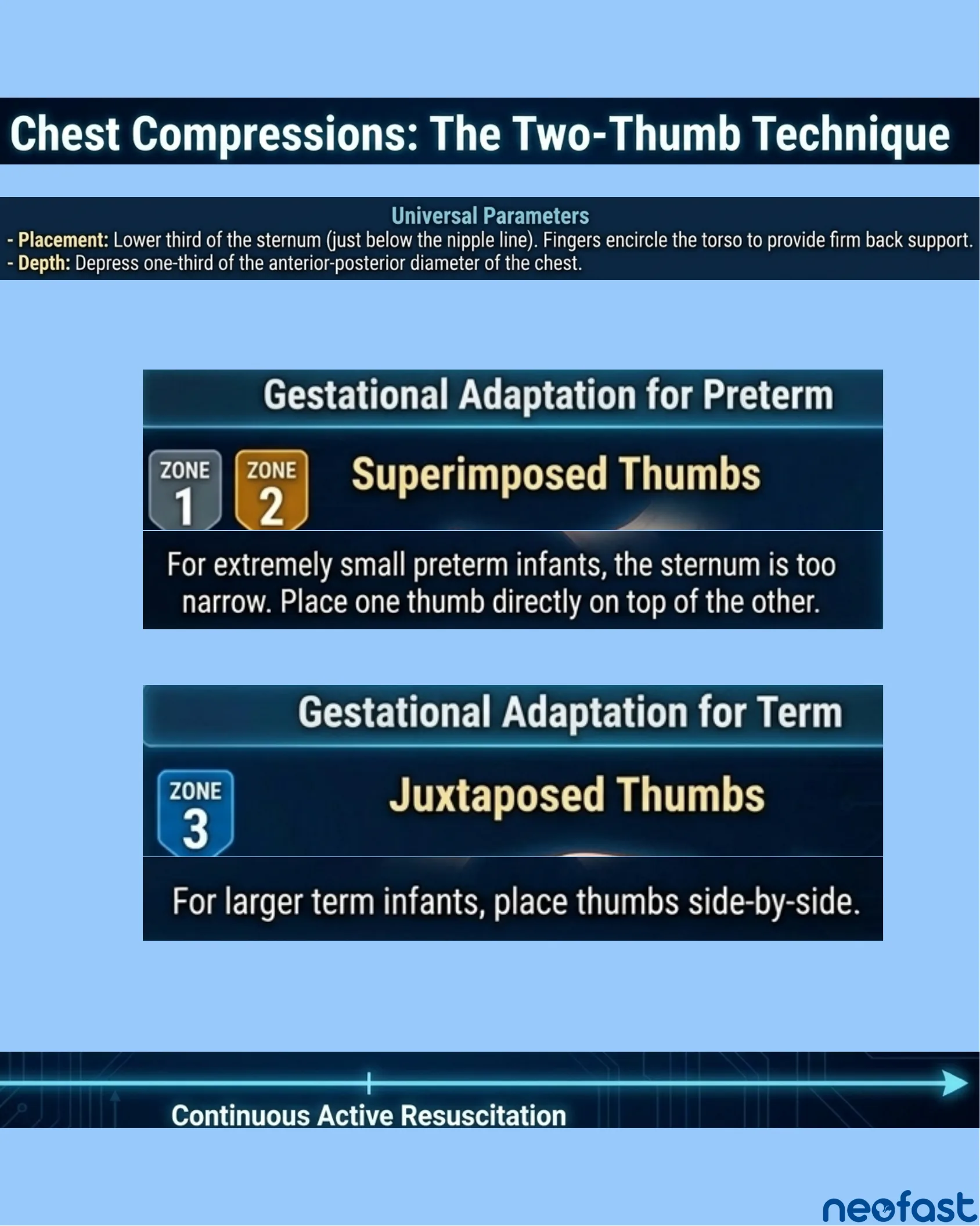Infographic detailing the two-thumb chest compression technique with gestational age adaptations for preterm (superimposed thumbs) and term (juxtaposed thumbs) infants.