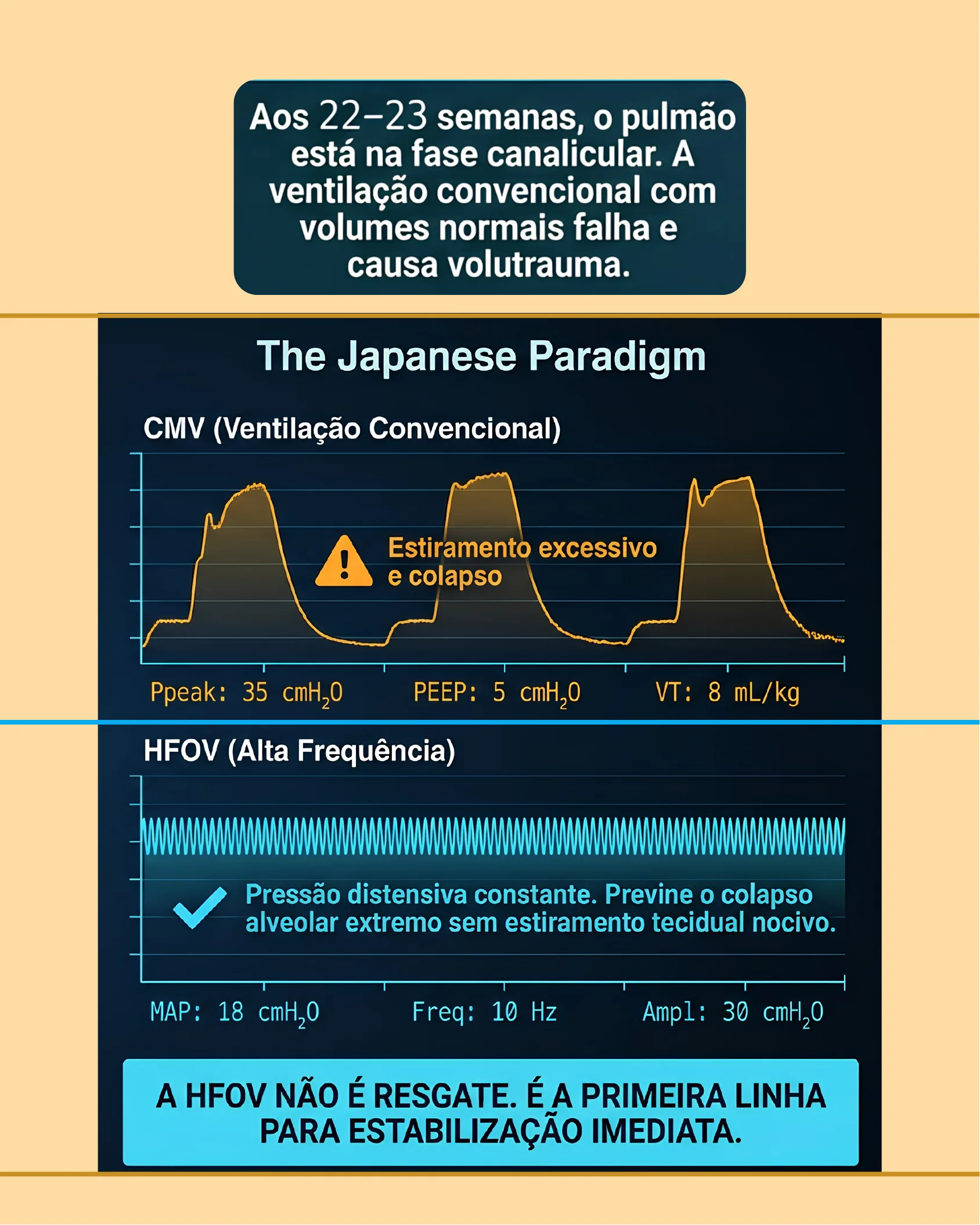 Gráfico comparando curvas de pressão da ventilação convencional (CMV) com estiramento excessivo e colapso versus a ventilação oscilatória de alta frequência (HFOV) com pressão distensiva constante.