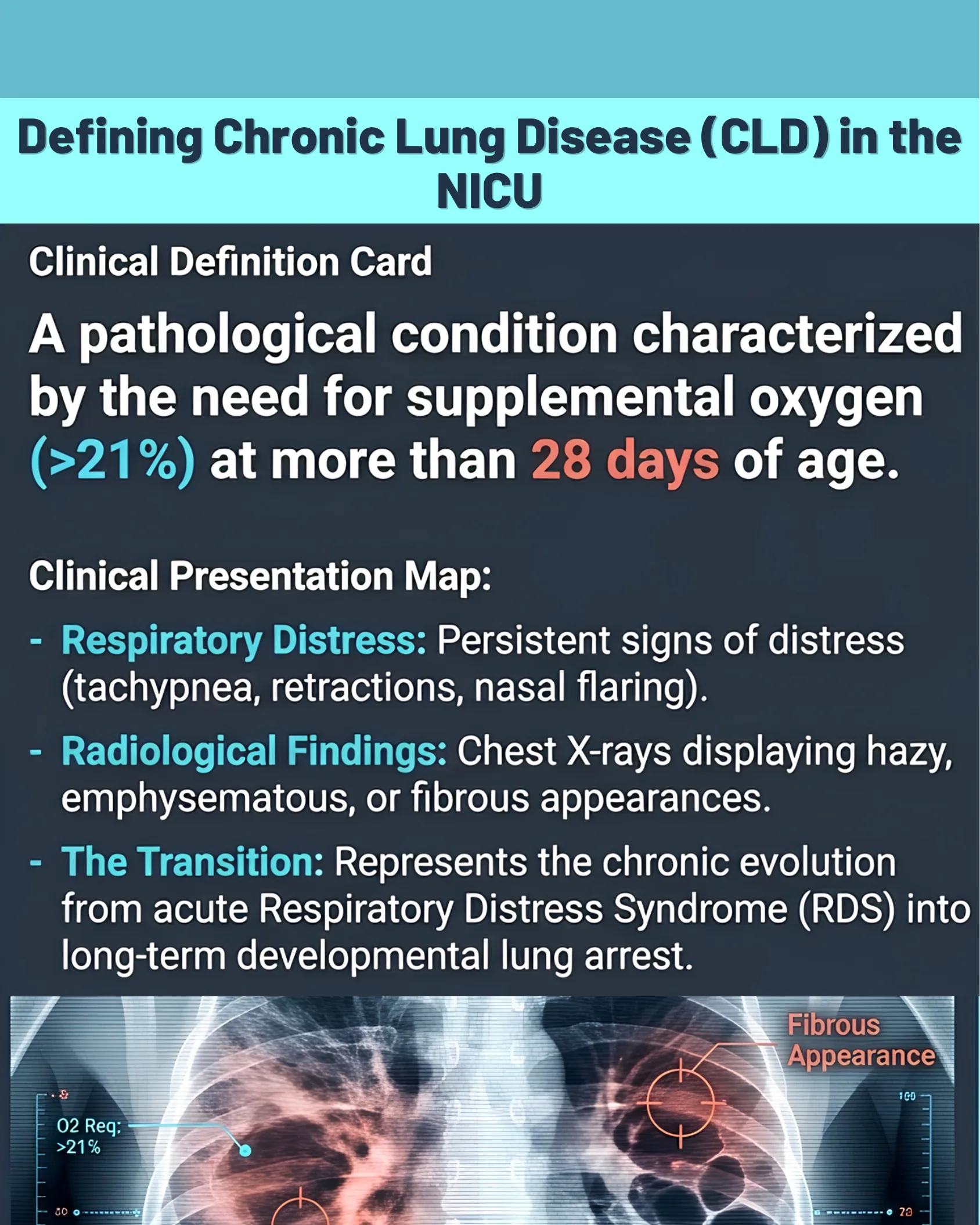 Clinical definition card describing chronic lung disease criteria and a neonatal chest X-ray with annotated fibrous appearance and oxygen requirement markers.