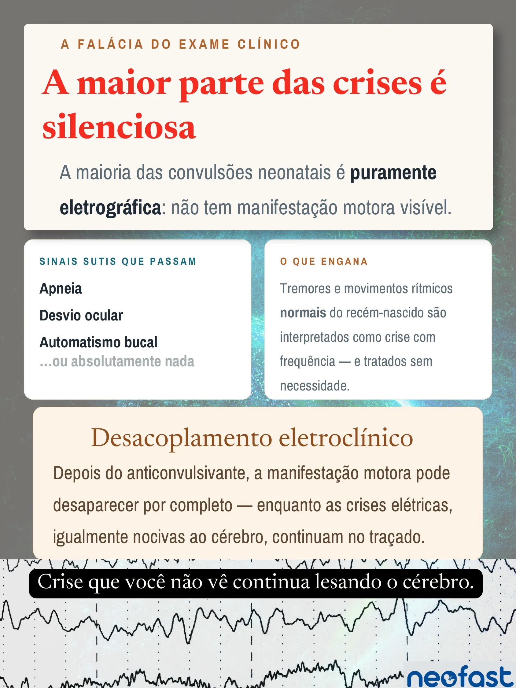 Infográfico sobre convulsões neonatais eletrográficas silenciosas, com traçado de eletroencefalograma na base da página e caixas explicando sinais sutis e desacoplamento eletroclínico.
