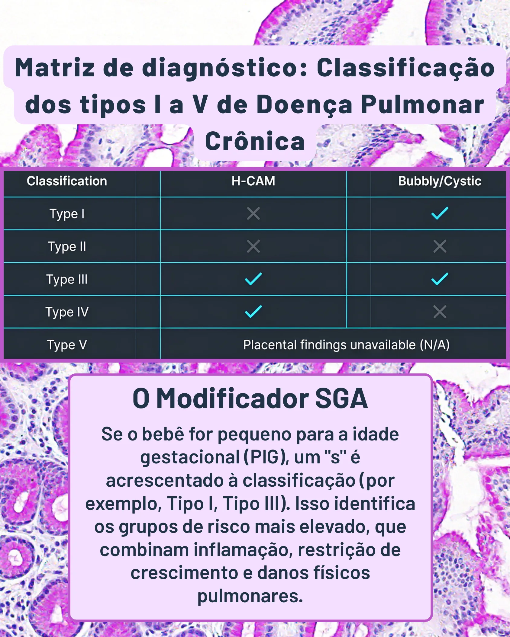 Tabela mostrando a classificação dos tipos I a V de doença pulmonar crônica conforme presença de H-CAM e padrão Bubbly/Cystic, com explicação do modificador SGA.