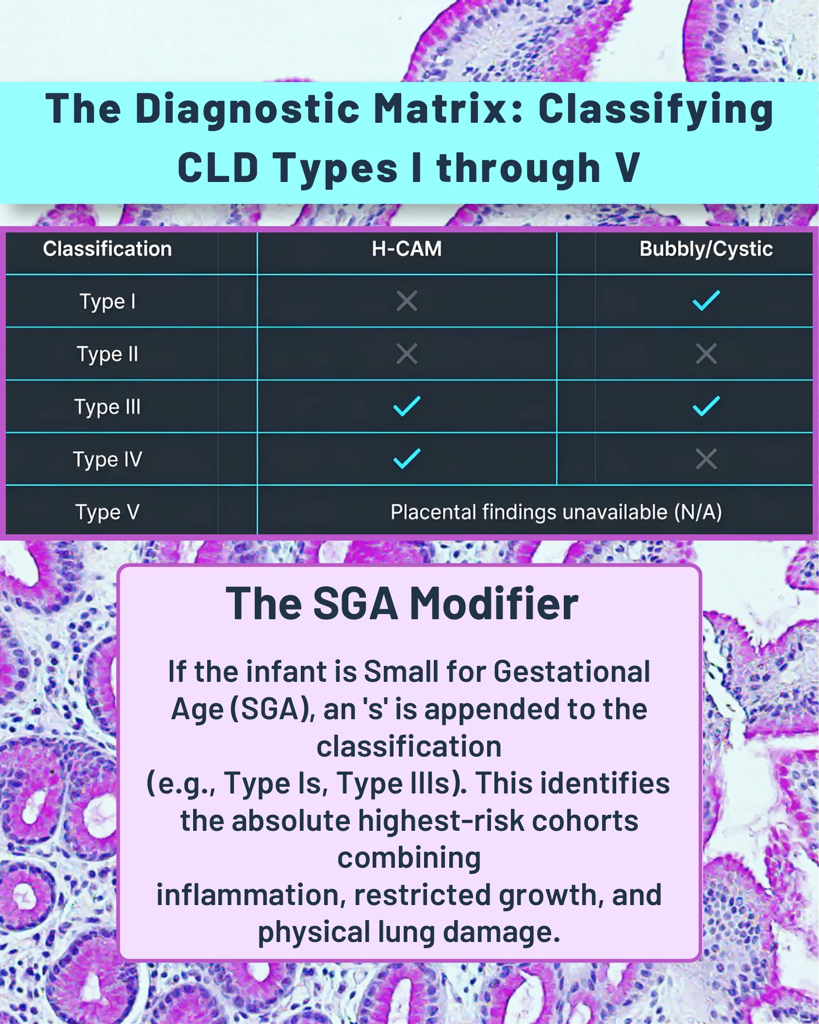 Table classifying CLD Types I-V by H-CAM and Bubbly/Cystic findings, with a note on the SGA modifier appending 's' to the classification.