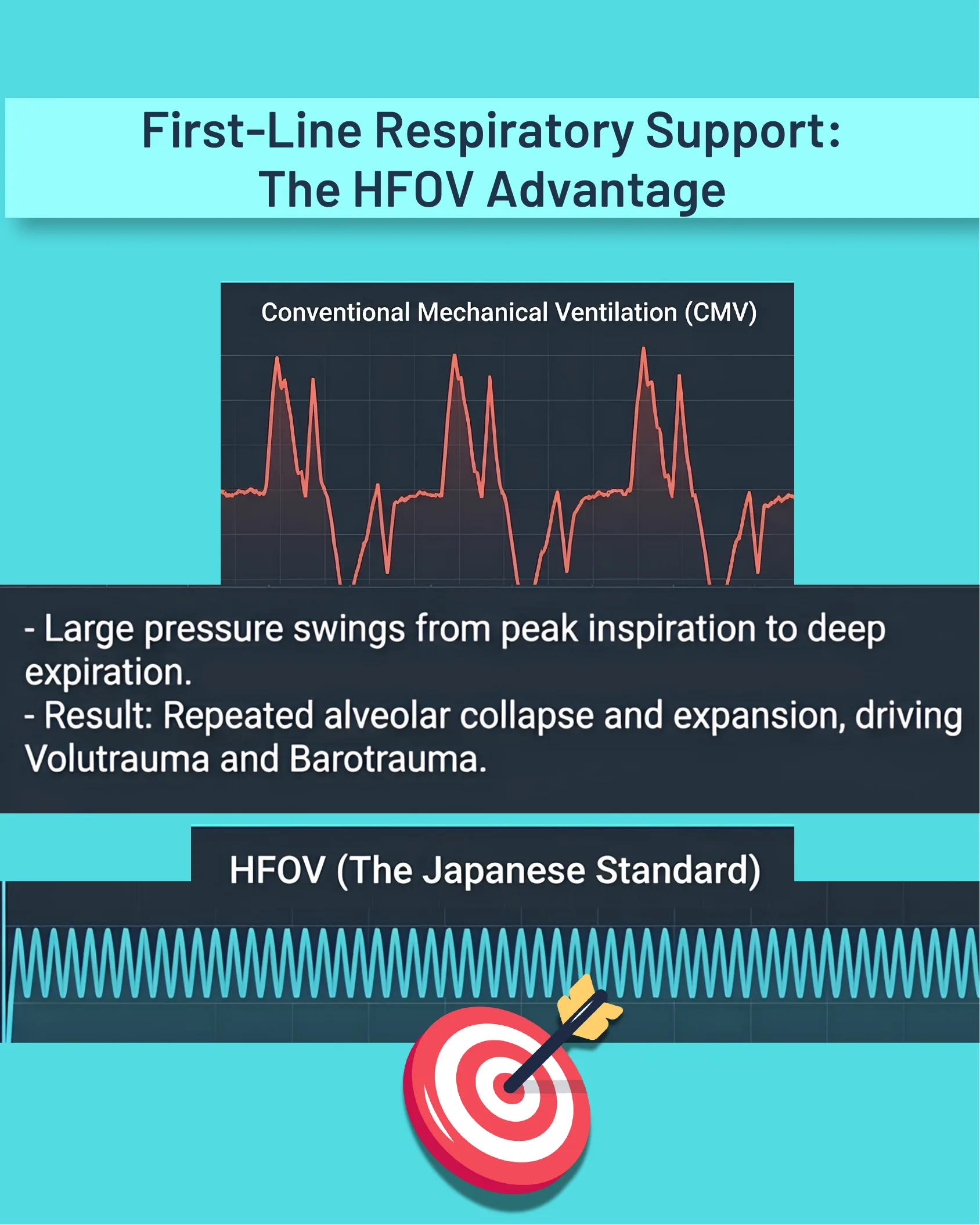 Waveform comparison chart contrasting Conventional Mechanical Ventilation pressure swings with the constant high-frequency waveform of HFOV, the Japanese standard.