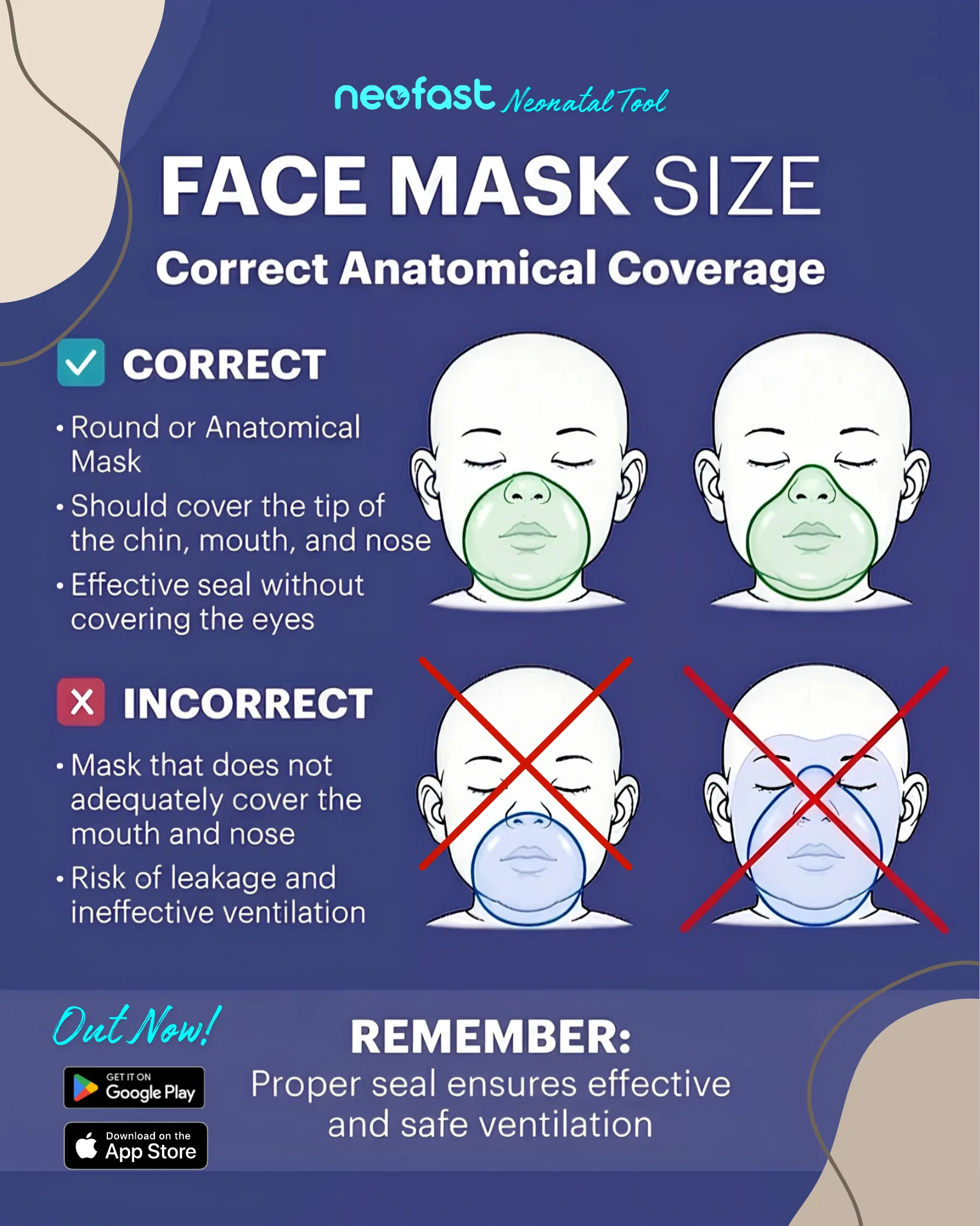 Infographic showing correct and incorrect neonatal face mask placement on infant faces, illustrating proper coverage of chin, mouth, and nose versus improper masks that fail to seal or cover the eyes.