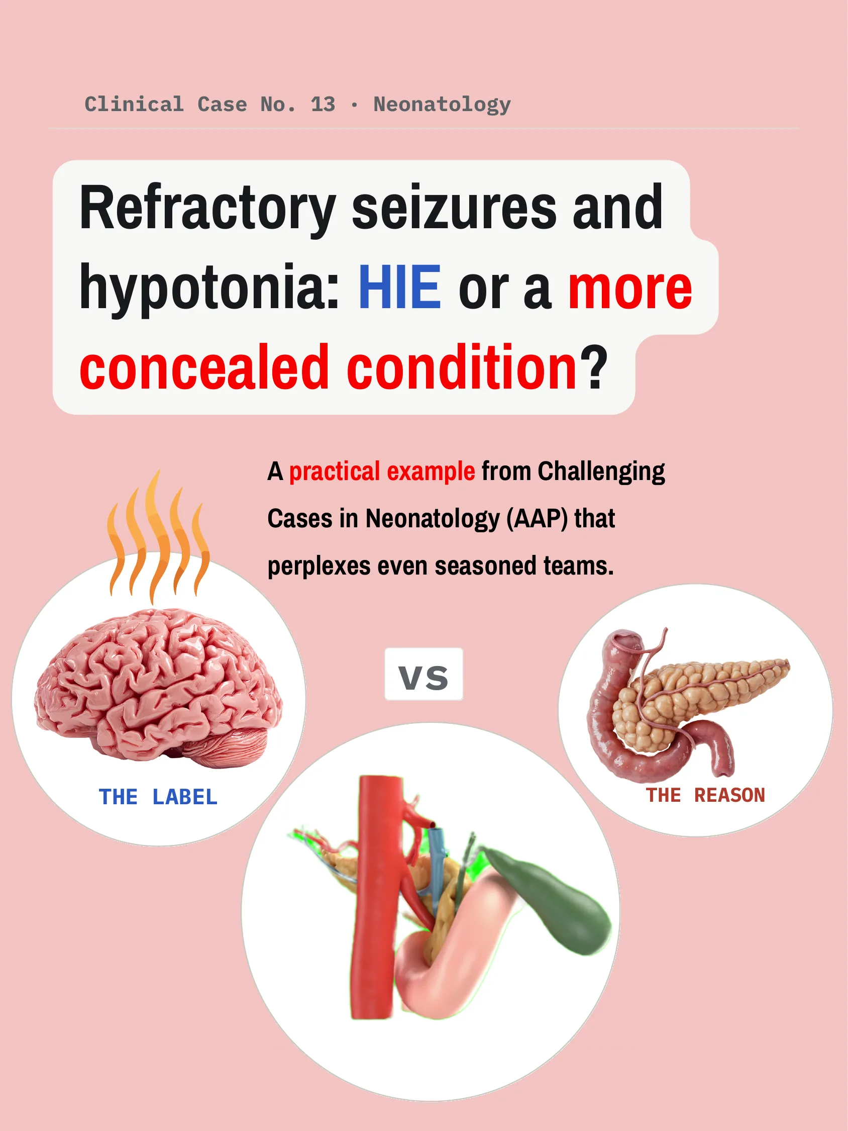 Refractory Seizures and Hypotonia: HIE or a More Concealed Condition?