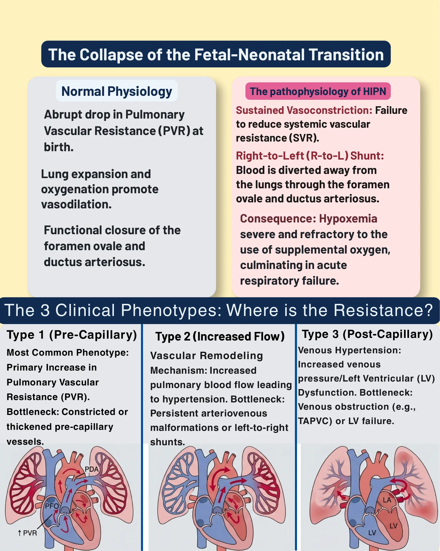 Comparação entre a fisiologia normal da transição pulmonar ao nascimento e a fisiopatologia da HIPN, com ilustração dos três fenótipos clínicos de shunt cardíaco.