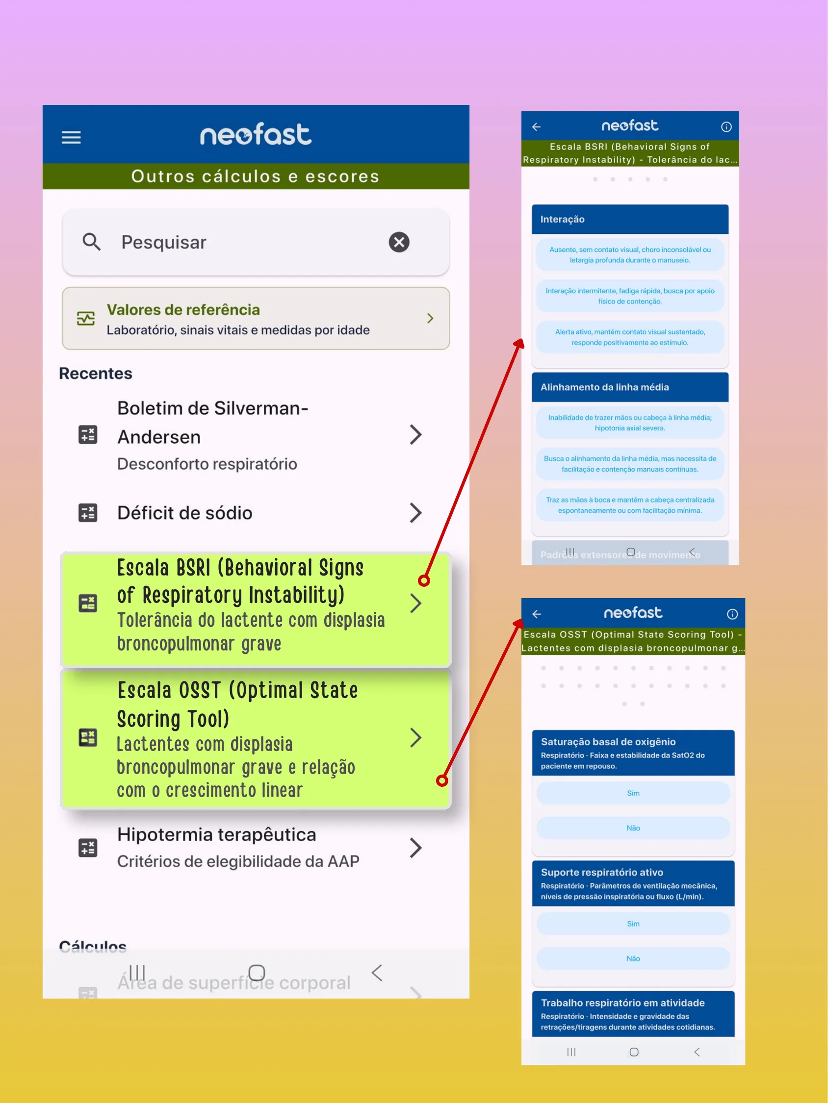 Capturas de tela do aplicativo NeoFast mostrando a lista de outros cálculos e escores com destaque para a Escala BSRI e a Escala OSST, e as telas detalhadas de cada uma delas.