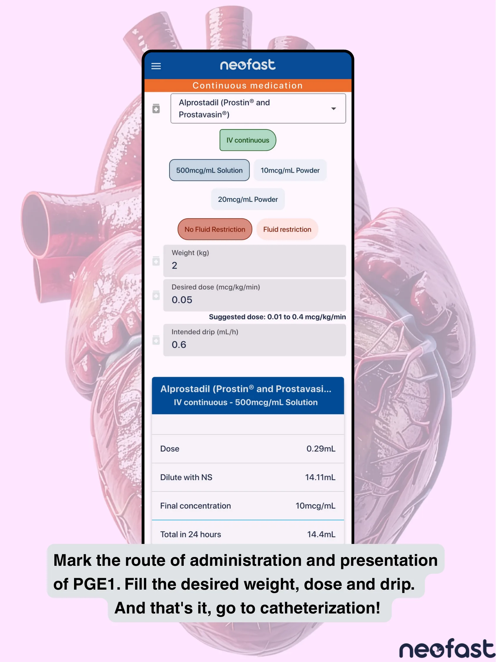 Screenshot of the Neofast app continuous medication calculator for Alprostadil (PGE1) showing dose, dilution, and infusion rate calculations