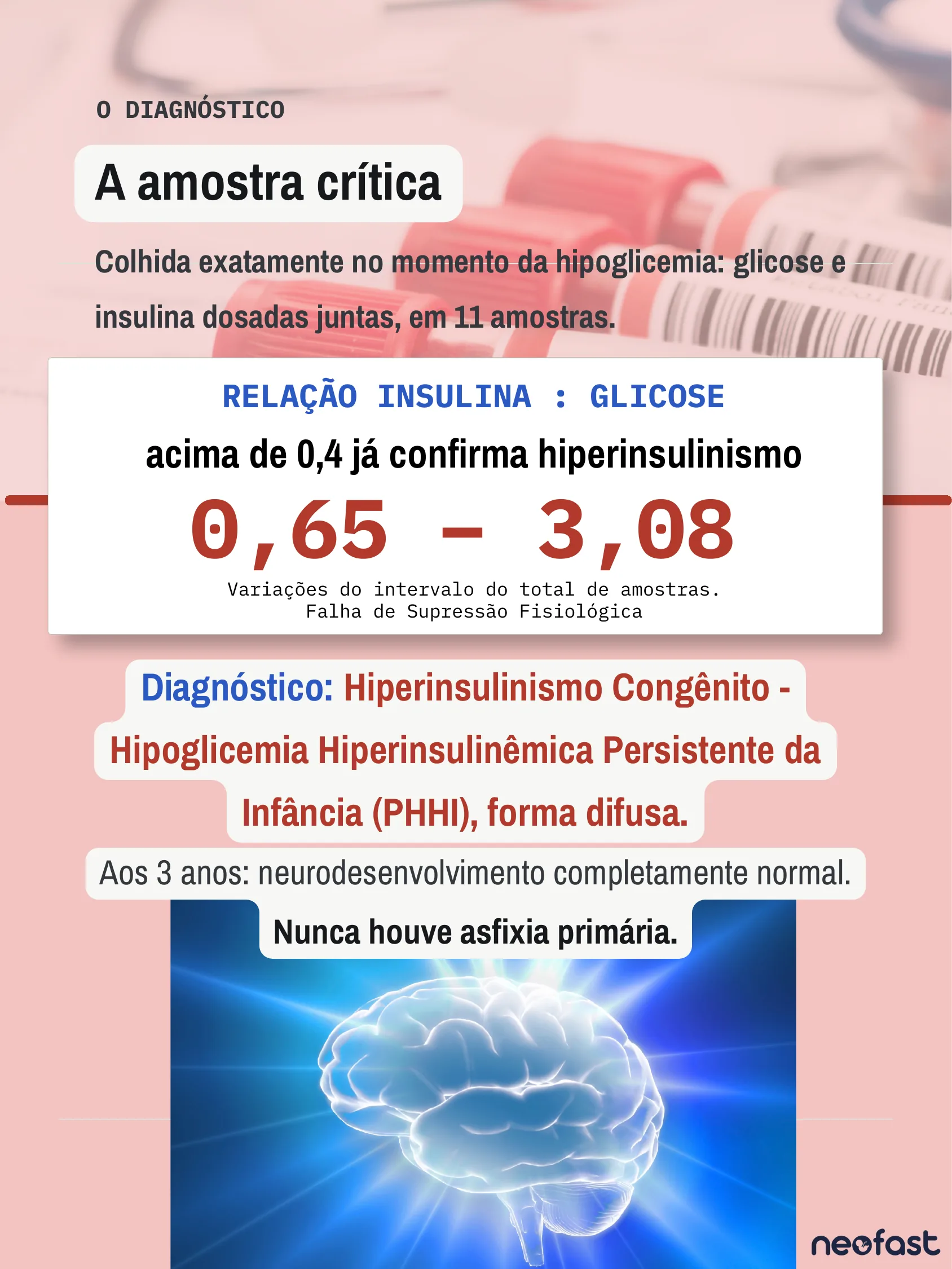 Página apresentando os resultados laboratoriais da relação insulina:glicose confirmando hiperinsulinismo congênito, com destaque para o desfecho neurológico normal aos 3 anos.