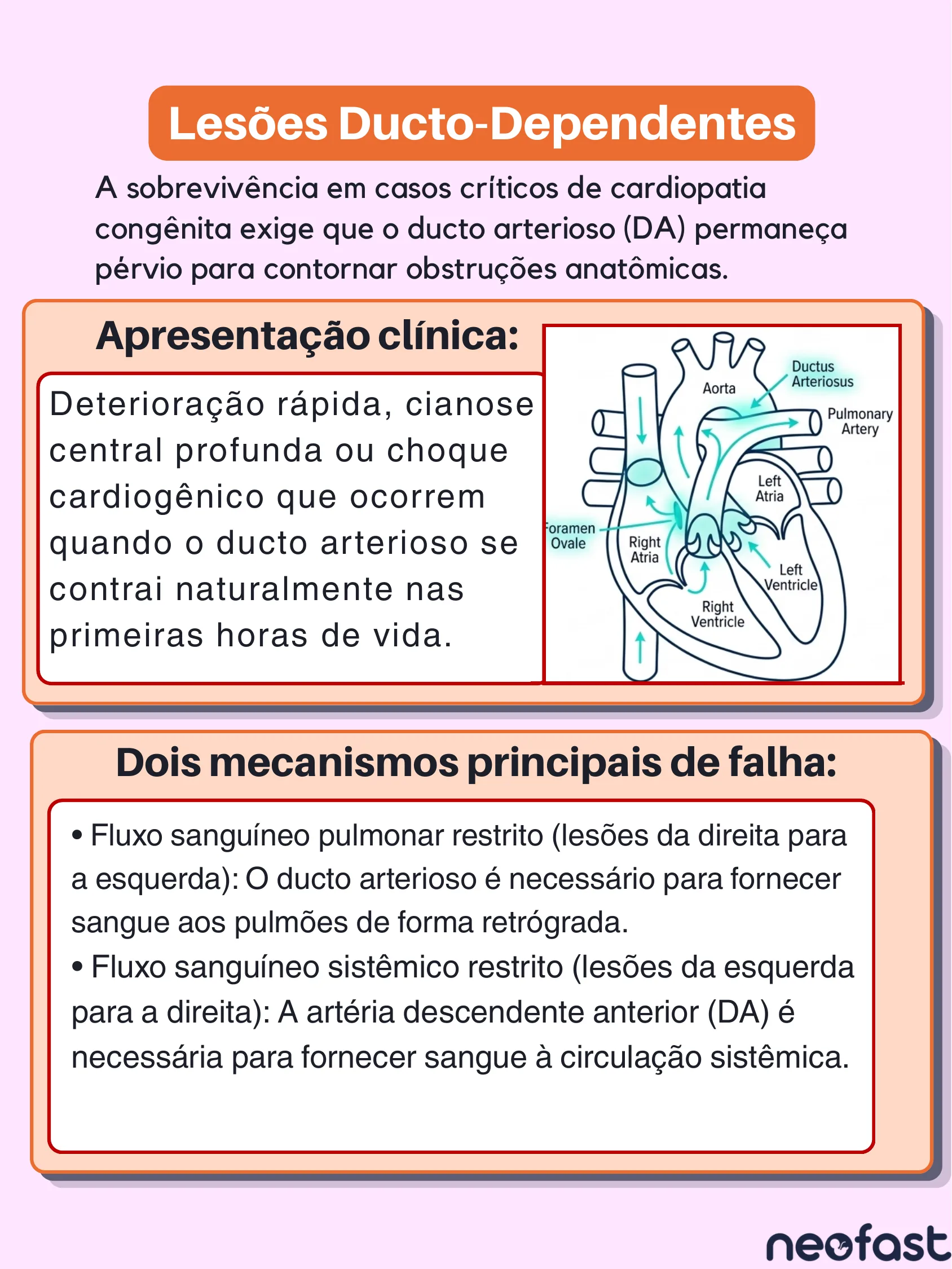 Diagrama do coração neonatal mostrando o ducto arterioso e explicação sobre lesões cardíacas ducto-dependentes.