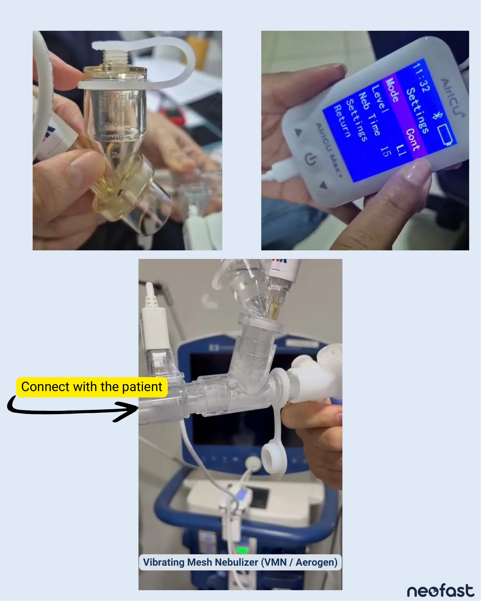 Three photographs demonstrating the setup of a vibrating mesh nebulizer including the medication chamber, the AiriCU Max+ nebulizer control device settings screen, and the connection point to the patient circuit.