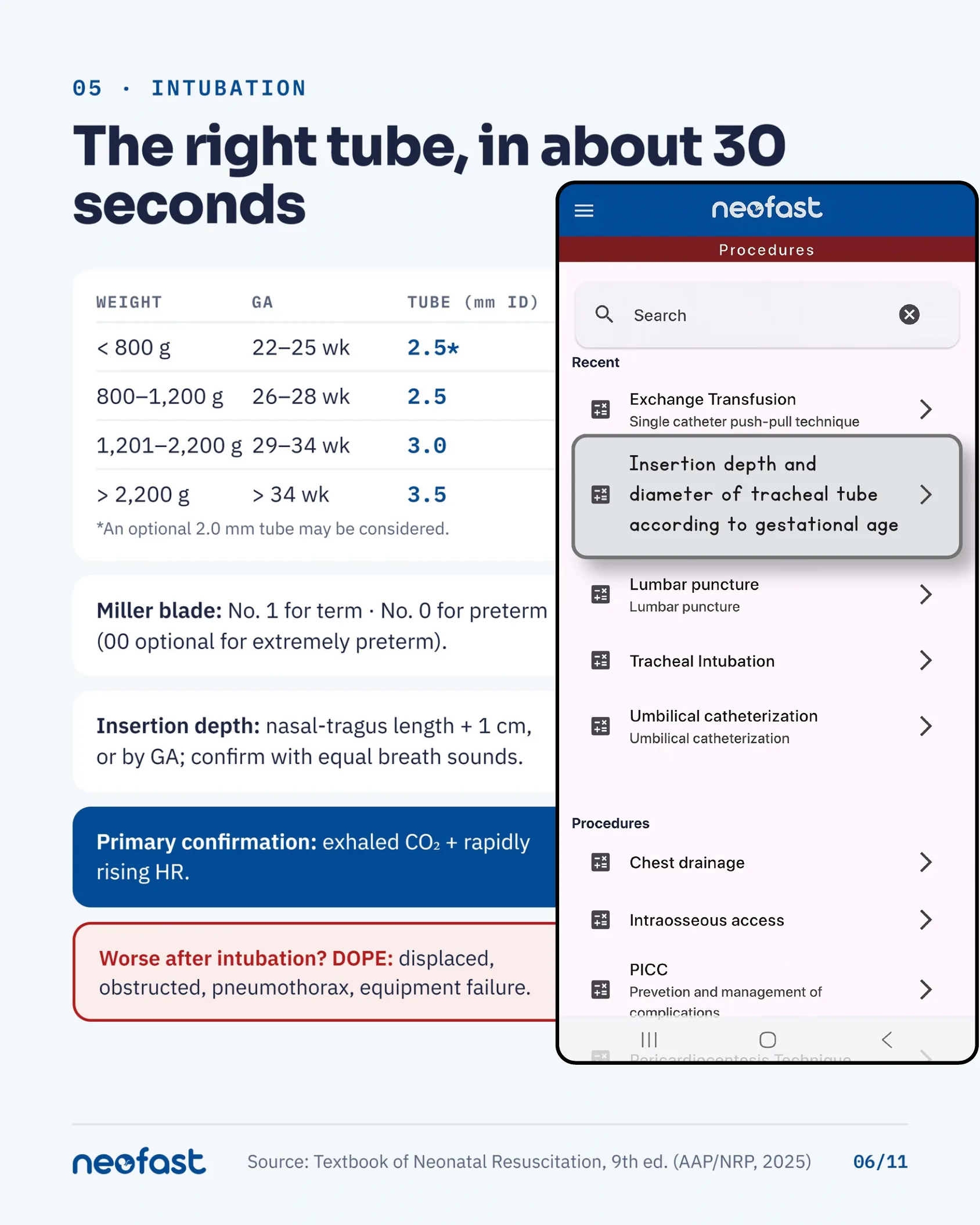 Table of endotracheal tube sizes by weight and gestational age, plus notes on blade selection, insertion depth, and confirmation of intubation, alongside a mobile app screen for tube sizing.