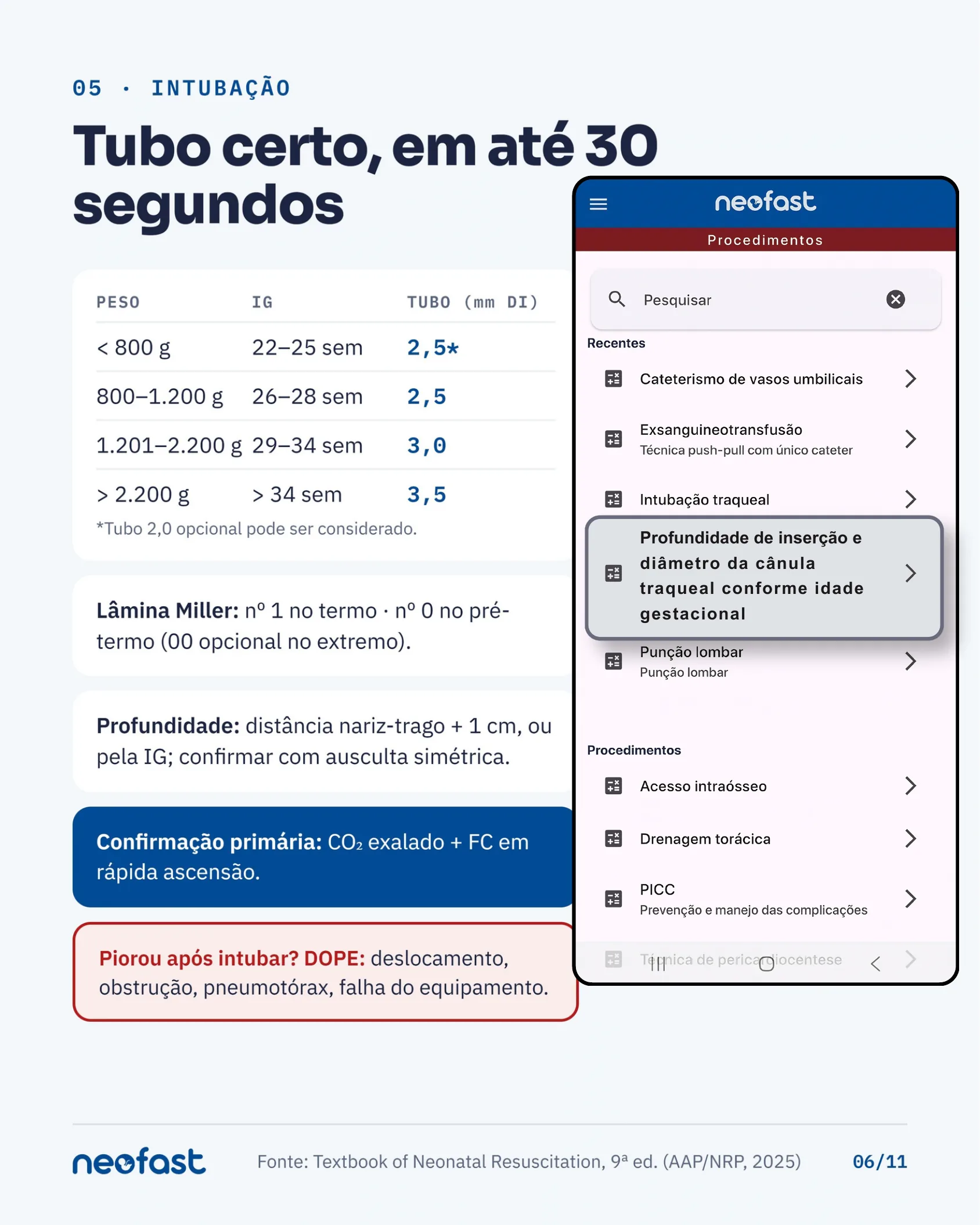 Tabela de escolha do tubo endotraqueal por peso e idade gestacional, com critérios de profundidade, confirmação e mnemônico DOPE, ao lado de um aplicativo mostrando a calculadora de intubação.
