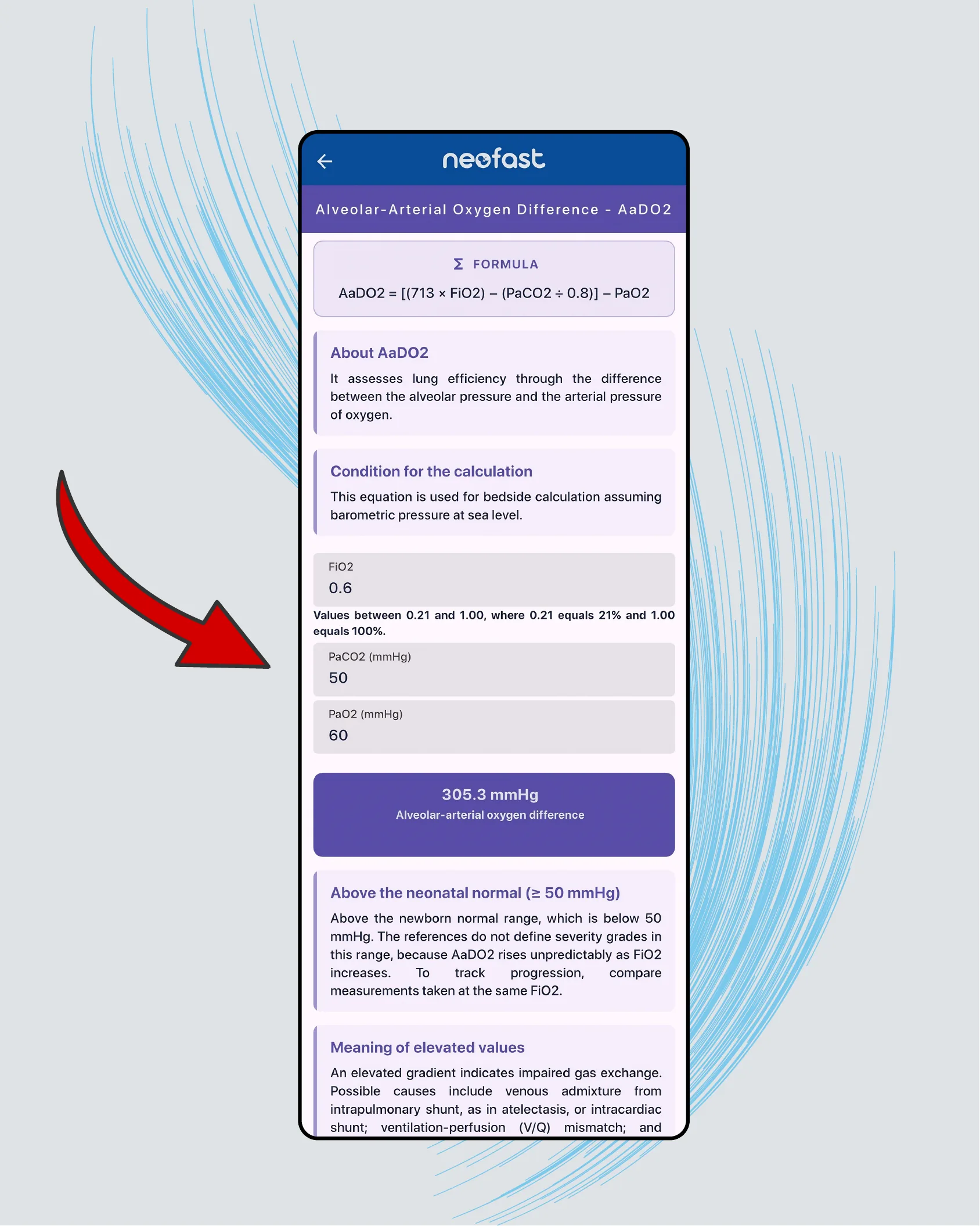 Mobile app screen showing the AaDO2 calculator with FiO2 0.6, PaCO2 50, PaO2 60 inputs, a calculated result of 305.3 mmHg, and interpretation text about elevated values above the neonatal normal range.